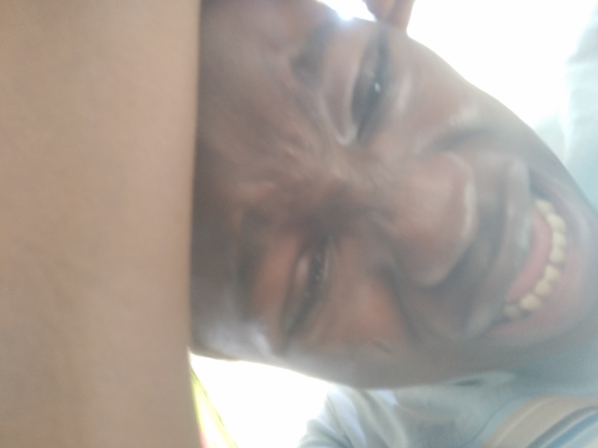 The image shows a close-up, slightly out-of-focus view of a person's face, positioned at an angle. The person appears to be smiling, exposing their teeth. The lighting is bright, possibly from natural sunlight. The location, Shangisha, Nigeria, cannot be verified from the image alone. No specific objects or environment are discernible beyond the person's face.