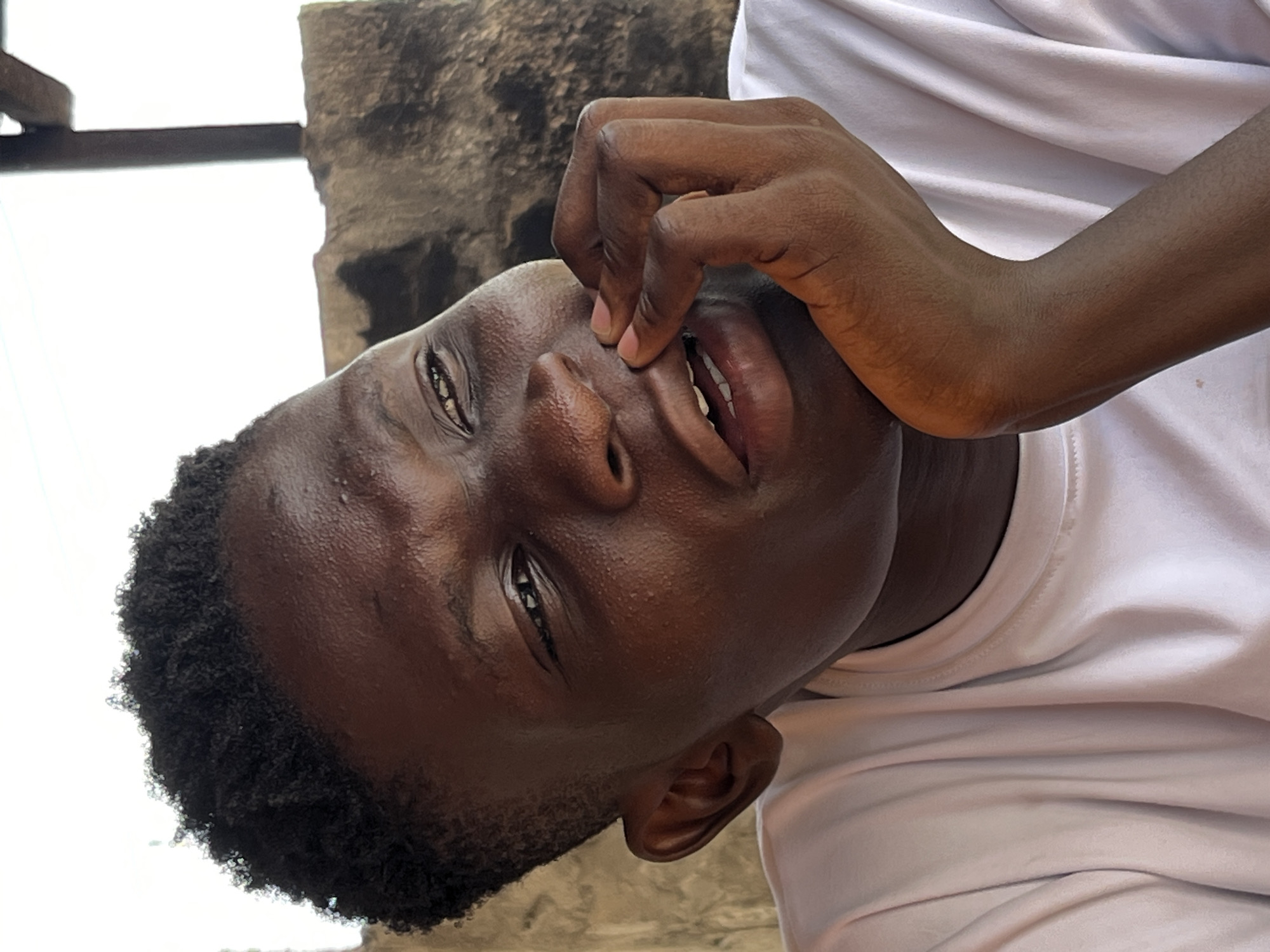 A close-up shot features a person with dark skin, short, curly hair, wearing a white T-shirt. The individual's face is the focal point, with a hand near their mouth. The background includes a textured, light-colored surface, possibly a wall, and a glimpse of a light sky above a dark structure. The location is suggested to be in the city of Badagry, Nigeria.