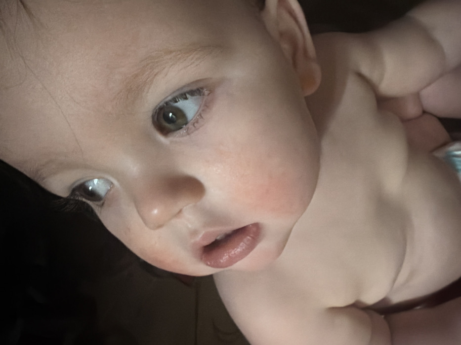 A close-up image captures a baby's face, tilted to the left. The baby has fair skin, hazel eyes, and soft features. One eye is focused with a visible glint of light. The lips are slightly parted, revealing a glimpse of the mouth's interior. The baby's skin has a reddish tone on the cheek. Part of the baby's shoulder and upper arm are visible, suggesting the baby is undressed. The background is dark and blurry.