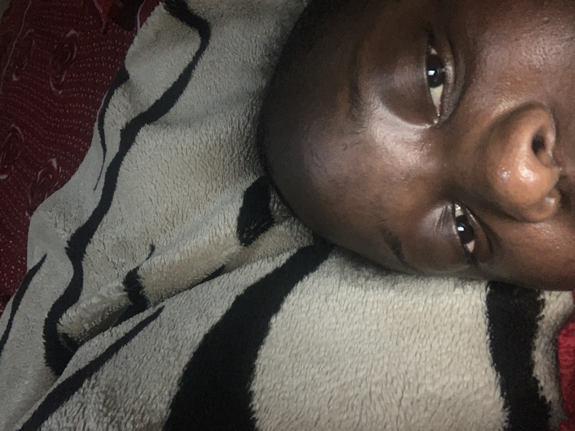 A close-up, eye-level, indoor photograph shows the upper portion of a person's face, specifically their forehead, eyes, and nose, as they lie on a bed covered with a patterned blanket. The blanket has broad, wavy stripes of black on a cream-colored background. To the upper right of the frame, a red patterned fabric is visible. The person's skin is dark brown, and their eyes are dark. The lighting is dim, casting a slight shadow on the left side of their face. The image appears to be a selfie taken at a very close range.