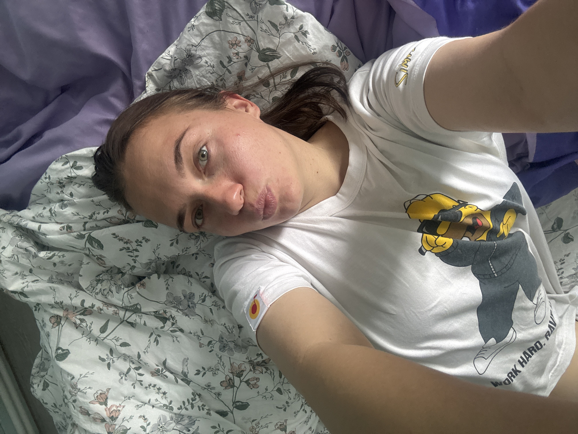 A woman lies on a bed, taking a selfie. The bed has two different patterned covers: one floral, the other solid purple. The woman wears a white t-shirt with a cartoon graphic. On her upper arm, there is a round, colorful bandage or sticker. The location of the photo is not discernible from the image, so I cannot confirm if it is in Раздолье, Russia.