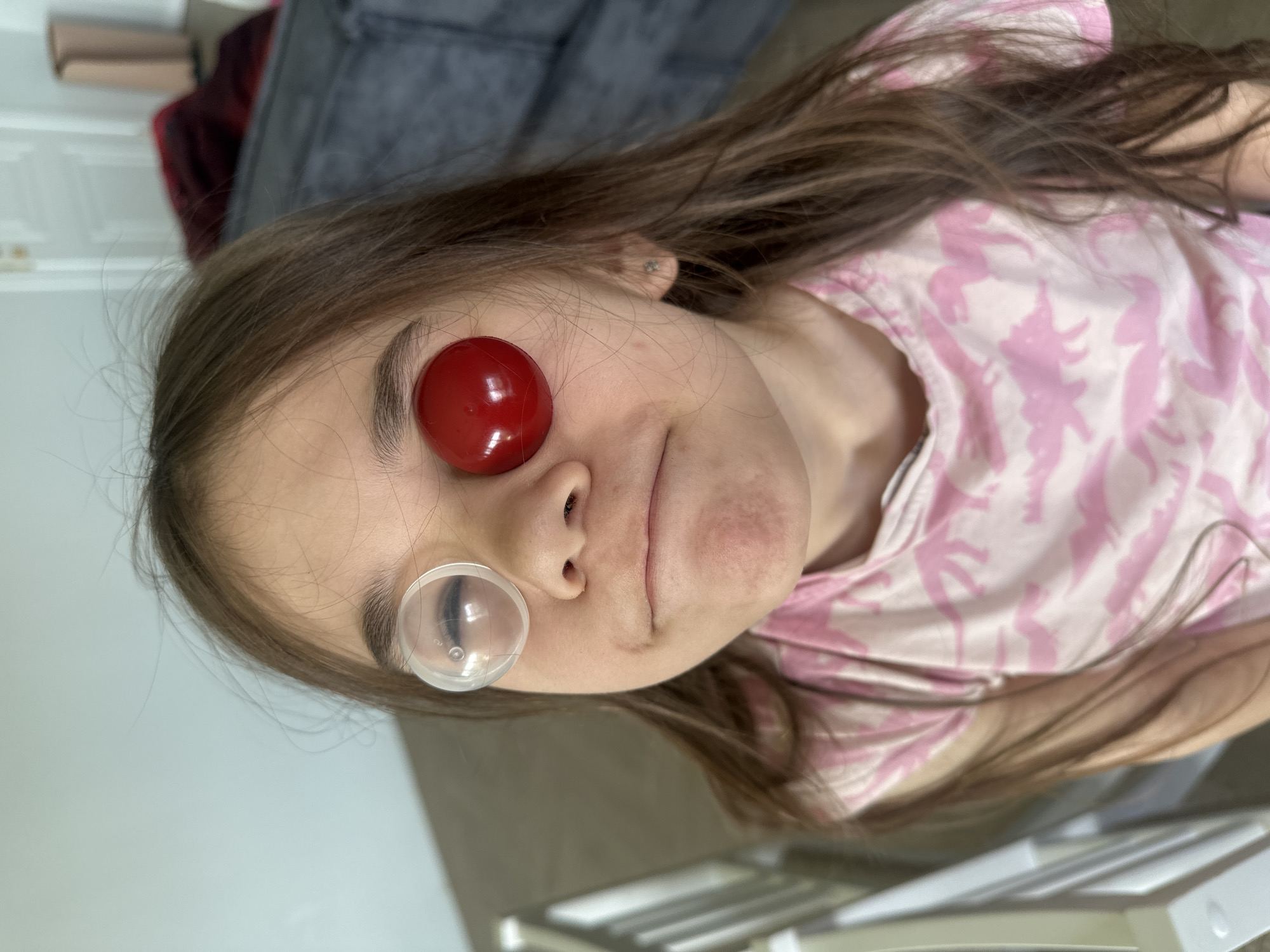 A young girl with brown hair is positioned at an unusual angle relative to the camera, which appears to be held slightly above and to the side. She has a shiny, red, spherical object placed over her left eye. Just below her nose on the right side of her face, she is wearing a clear, hemispherical object. The girl is wearing a pink and white patterned shirt. The background contains a gray couch and a white object with a grid pattern. There is no indication of the city Kharnavy, Russia.