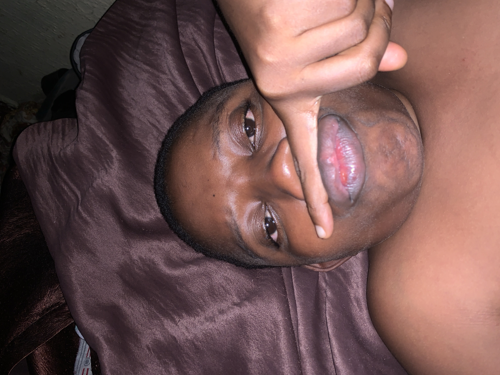 A close-up, slightly angled photograph shows a dark-skinned person lying on a brown, satin-like fabric. A hand is near the person's face, with a finger near the mouth, which has a visible sore on the lower lip. The person's eyes are open, and the background is out of focus. There is no verifiable information about Ikorodu, Nigeria.