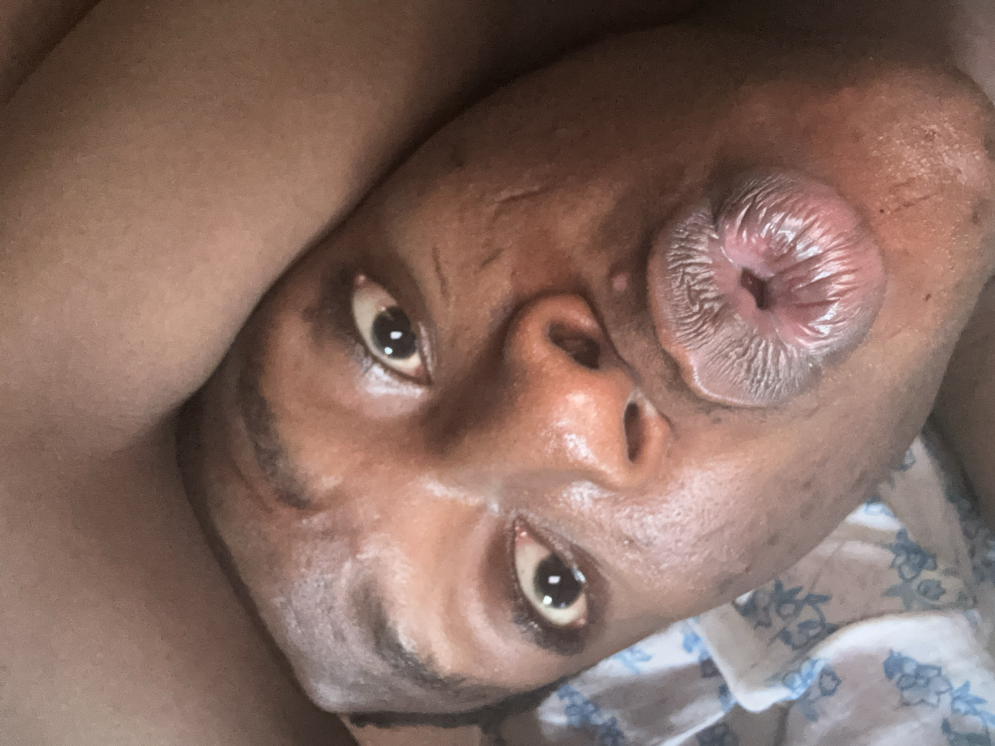 A close-up portrait of a dark-skinned individual, appearing to be resting on a bed. The person is gazing directly at the camera with a seemingly relaxed expression. Their face is the main focus, with an appendage present on their right cheek. The background includes what appears to be a bedsheet with a blue and white floral pattern. The location and city are unknown.