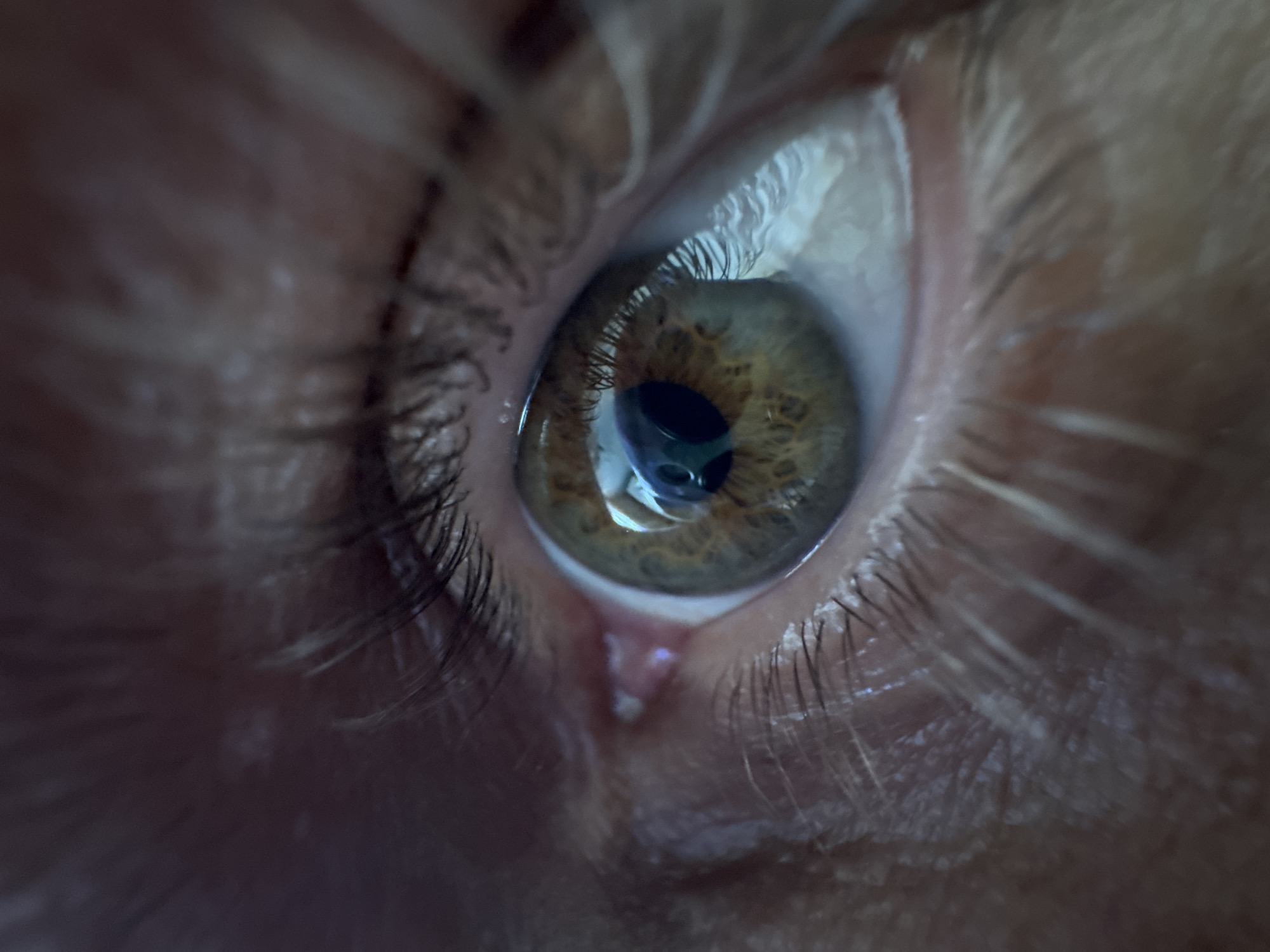 A close-up image focuses on a human eye. The eye's iris has a hazel color with a visible dark pupil at its center, where a reflection of light is present. The sclera around the iris is white. The eyelashes are dark and prominent on the upper and lower eyelids. Skin texture and fine lines are visible around the eye. No location information or reference to Ketoshi, Russia is ascertainable from this image.
