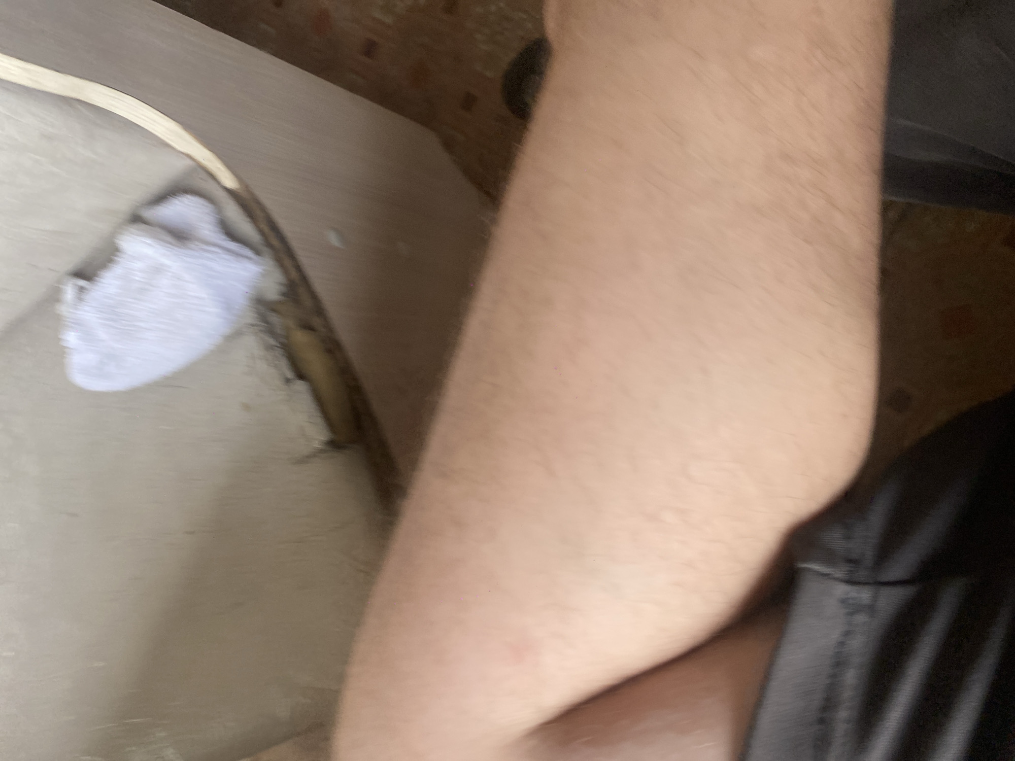 The image is a close-up, blurred, and likely indoor shot, focusing on a person's arm and leg. The skin appears to be fair and covered with light hair. The person is wearing dark shorts. In the background, a light-colored surface with visible texture and some discoloration is present. A small white object, possibly a cloth, is resting on this surface, which appears to be part of a piece of furniture with a curved edge. The flooring is a patterned tile. The image does not contain any information that would allow for the identification of its location within the city of Chunsky, Russia.