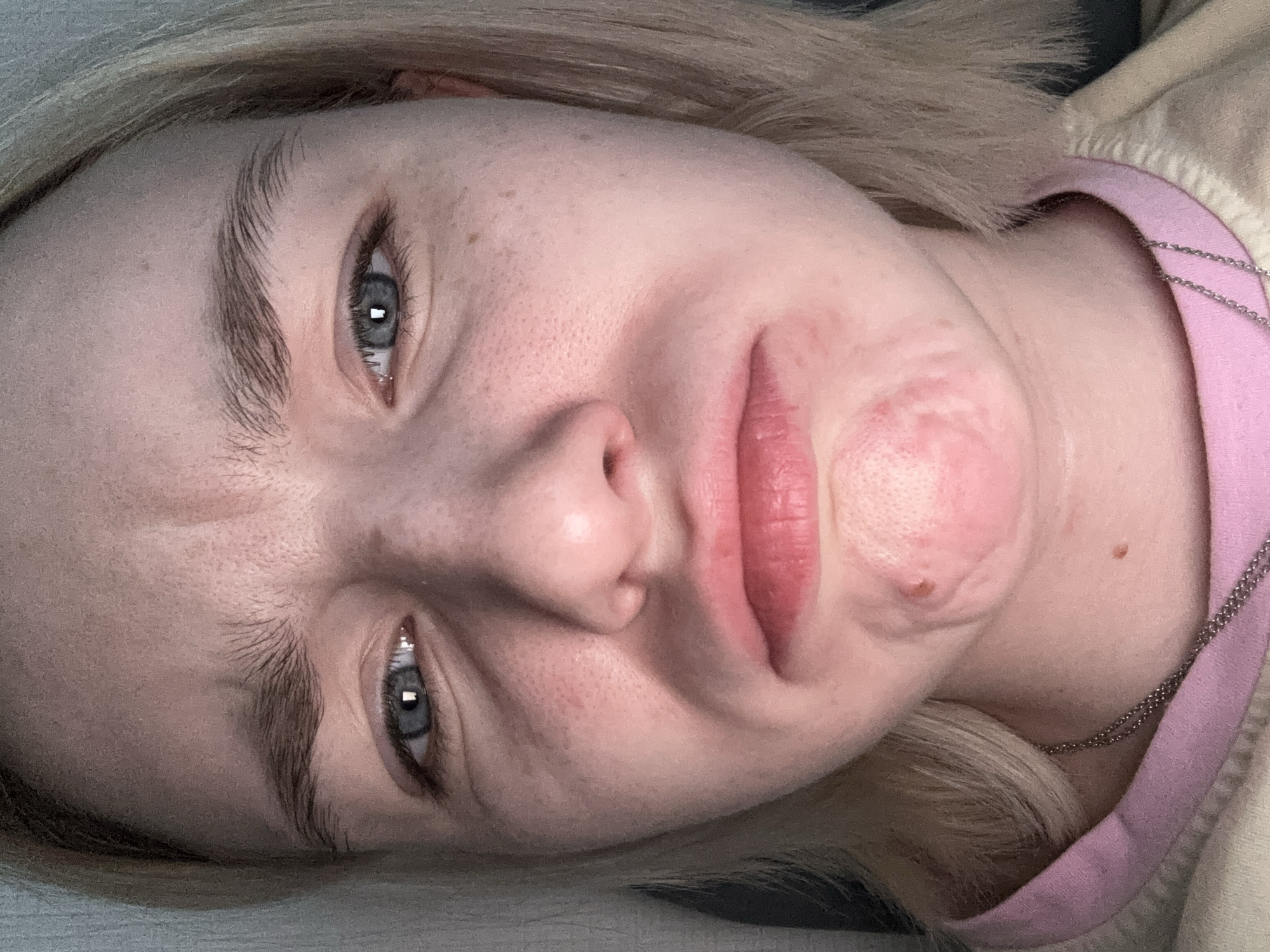 A close-up portrait of a fair-skinned person with blonde hair and blue eyes, taken from a low angle. The person has visible skin imperfections, including freckles and a raised skin condition around the mouth. The person is wearing a two-tone shirt or sweater with a pink collar and a beige top layer, and a silver chain necklace is visible. The background is a neutral tone, and there is no indication of the location being Vsevolozhsk, Russia.