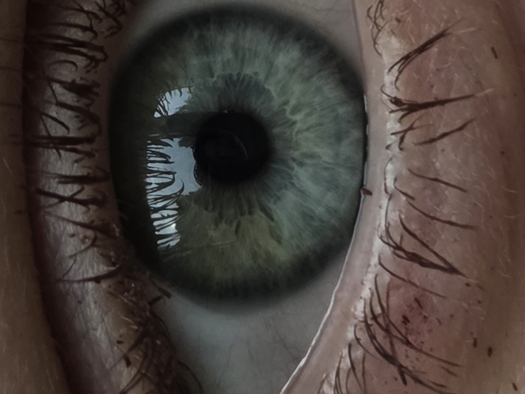 A close-up, high-magnification image depicts a human eye. The iris is predominantly green with intricate radial patterns, blending into shades of darker green and lighter blue-green. The pupil is central, black, and appears dilated. A distinct, inverted reflection on the cornea shows the outlines of trees or foliage against a light background, indicating an external light source. Visible are dark eyelashes on both the upper and lower eyelids. The upper lashes appear somewhat clumped, while the lower lashes are sparser. The skin surrounding the eye exhibits natural texture, small hairs, and minor reddish discoloration or marks below the lower lash line. A small portion of the sclera is visible to the left of the iris, displaying a grayish-white hue with faint vascularity.