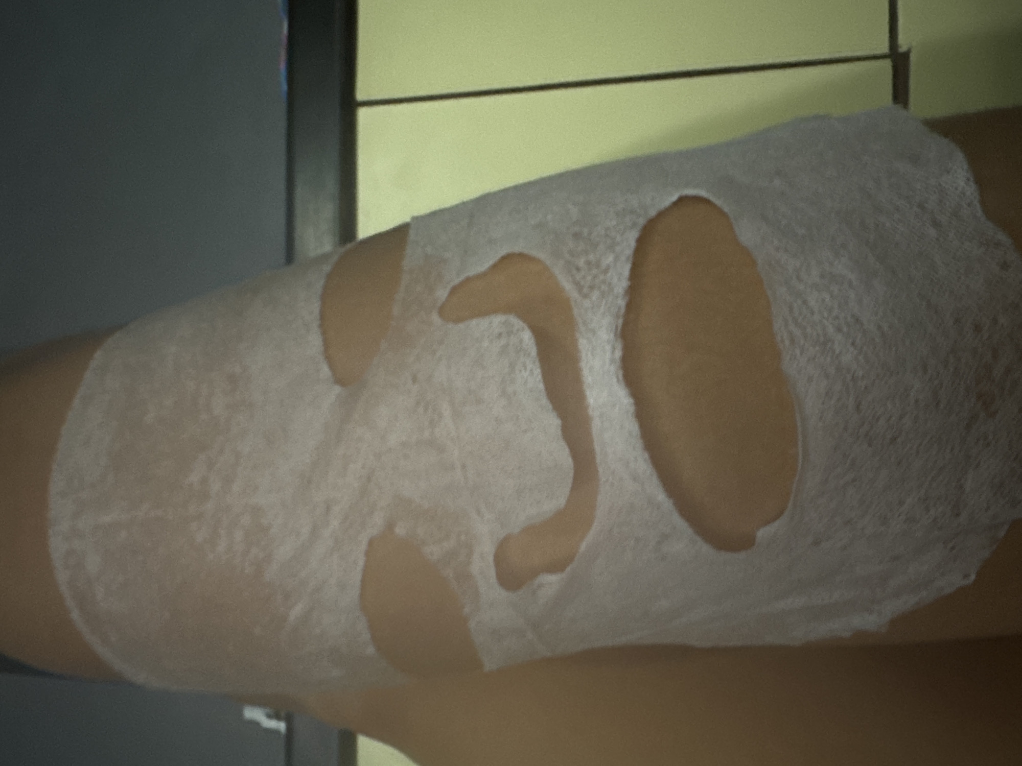 A person lies down with a white sheet-like face mask on their face. The face mask has openings for the eyes and mouth. The background consists of a gray wall with a yellow panel. The location is unknown.