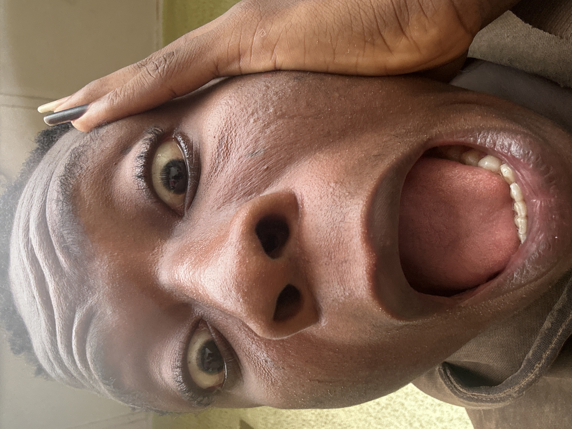 A close-up, tilted portrait shows a person with dark skin, an open mouth, and a hand resting on their forehead. The person's eyes are wide, and their teeth are visible. The image appears to be taken at a close range, emphasizing the details of the person's face. The environment is unclear. The location is listed as Unknown, Unknown.