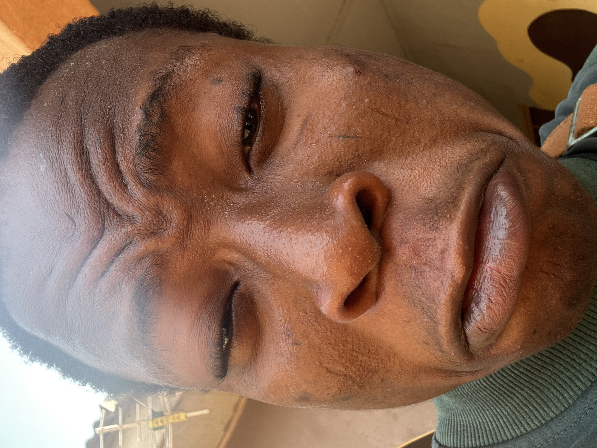 The image is a close-up of a person's face, possibly male, with dark skin, curly hair, and facial features like eyes, nose, and lips visible. The person appears to be looking downward. There is a green collared shirt visible. A partially visible structure is in the lower left. The location is unknown.