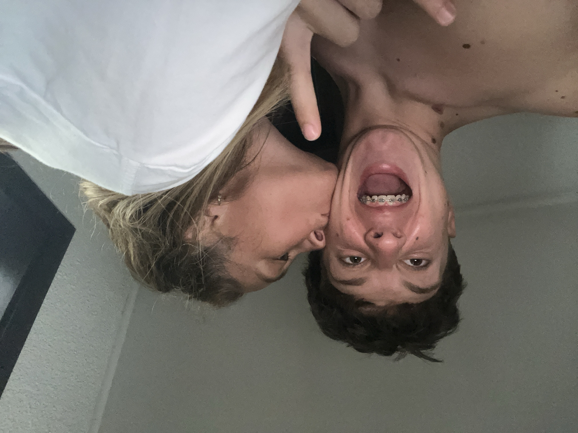 In an indoor setting with a plain, textured wall, two individuals are captured in a close-up photograph. The person on the left, a young male with dark, tousled hair and braces on his teeth, is making a surprised facial expression with his mouth wide open. He is shirtless. The person on the right, a young female with blonde hair, is leaning in and kissing the male on the cheek. She is wearing a white collared shirt. The interaction appears playful and affectionate. The lighting suggests it is likely daytime, with light coming from the right side of the frame.