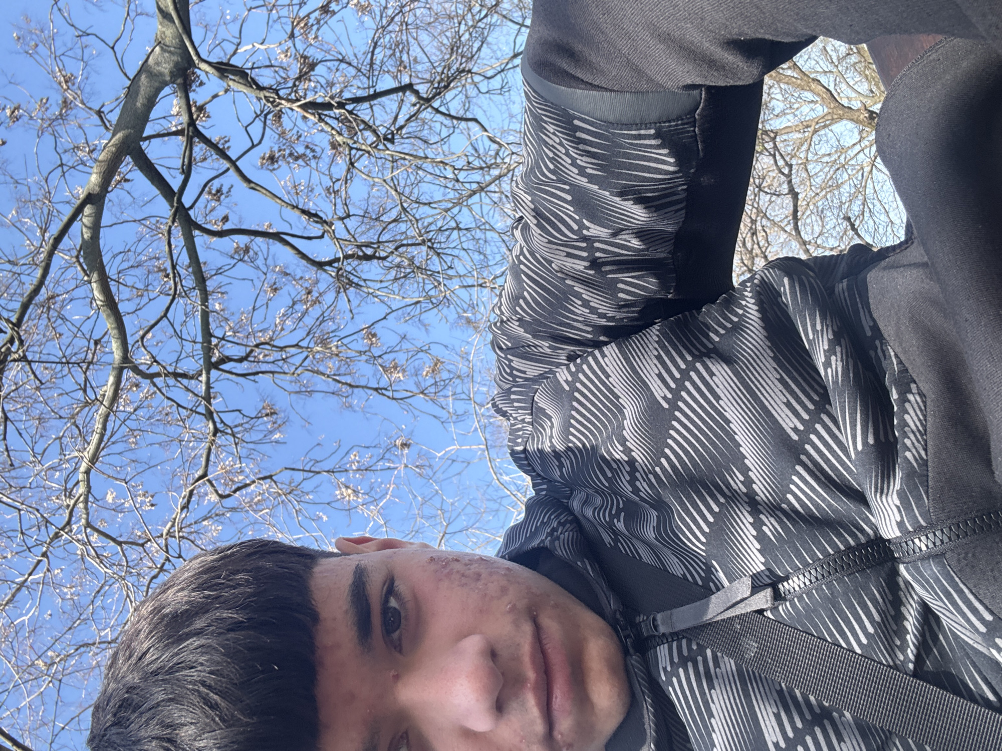 A low-angle selfie of a young man with dark hair and visible acne on his right cheek. He wears a black and gray patterned hoodie. Above him, bare tree branches are silhouetted against a pale blue sky. The location is unclear, and there is no clear indication of Saedinenie, Bulgaria.