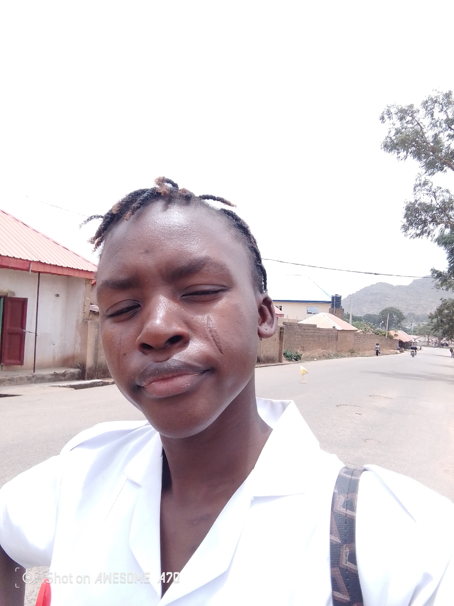 A medium shot depicts a person with dark skin and braided hair, wearing a white collared shirt and a patterned strap over their shoulder, standing on a street in Unknown, Unknown. The person has prominent scars on their cheek. The background shows a street with houses and buildings on either side. A tree is visible on the right. In the distance, there is a small hill or mountain.