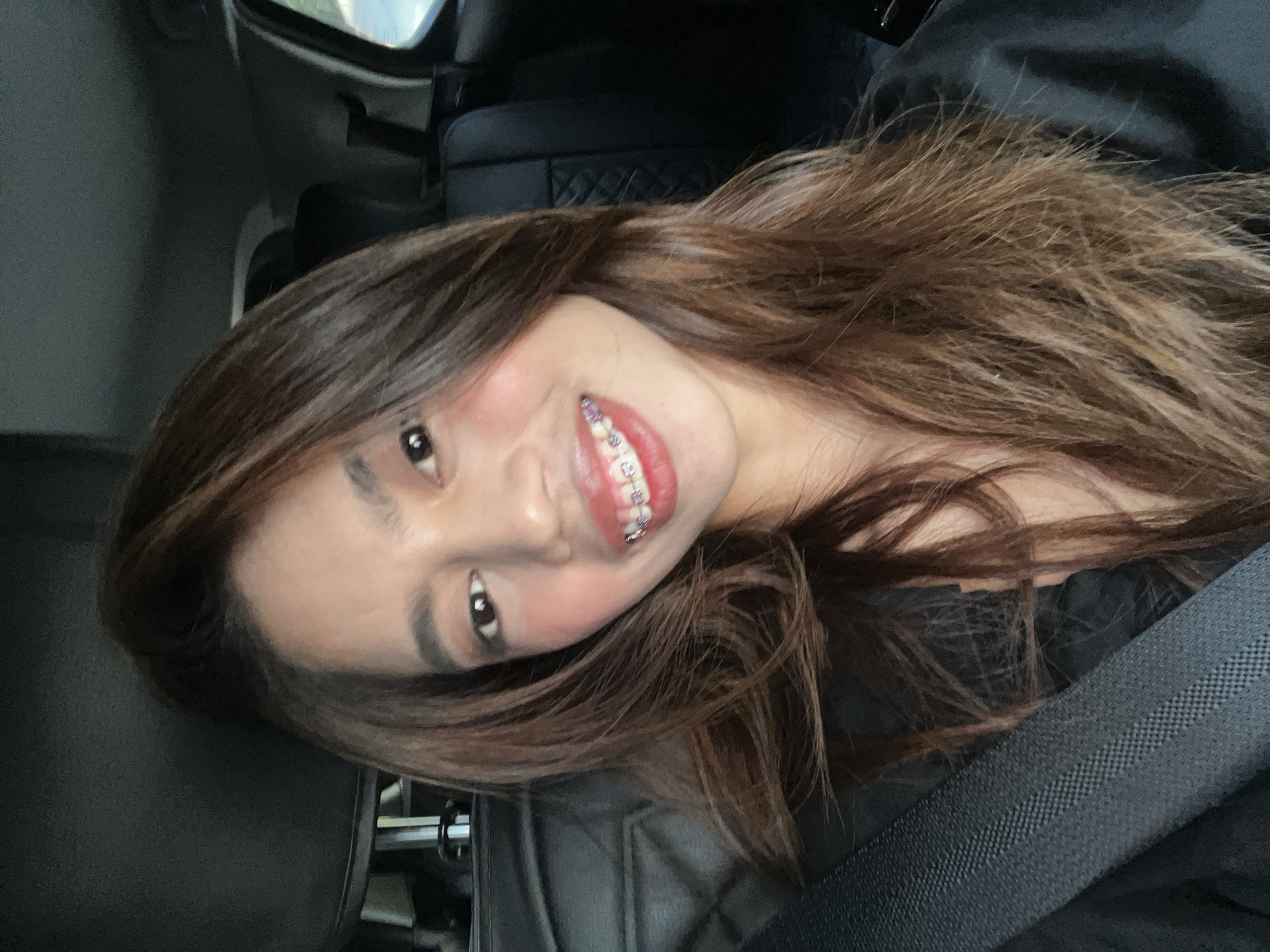 The image depicts a young woman seated inside a vehicle, located in Davao City, Philippines. She is facing forward, looking directly at the camera with a broad smile that reveals her upper teeth, fitted with dental braces featuring metallic brackets and purple elastic bands. Her long, dark brown hair cascades over her shoulders. She is wearing a dark-colored garment and a black seatbelt, which is fastened across her chest. The vehicle's interior is dark, with visible dark-colored seats; the passenger seatback to the right features a quilted stitching pattern. A dark headliner is visible above. Through the passenger window on the right, a blurry outdoor environment, indicating daylight, is faintly discernible.