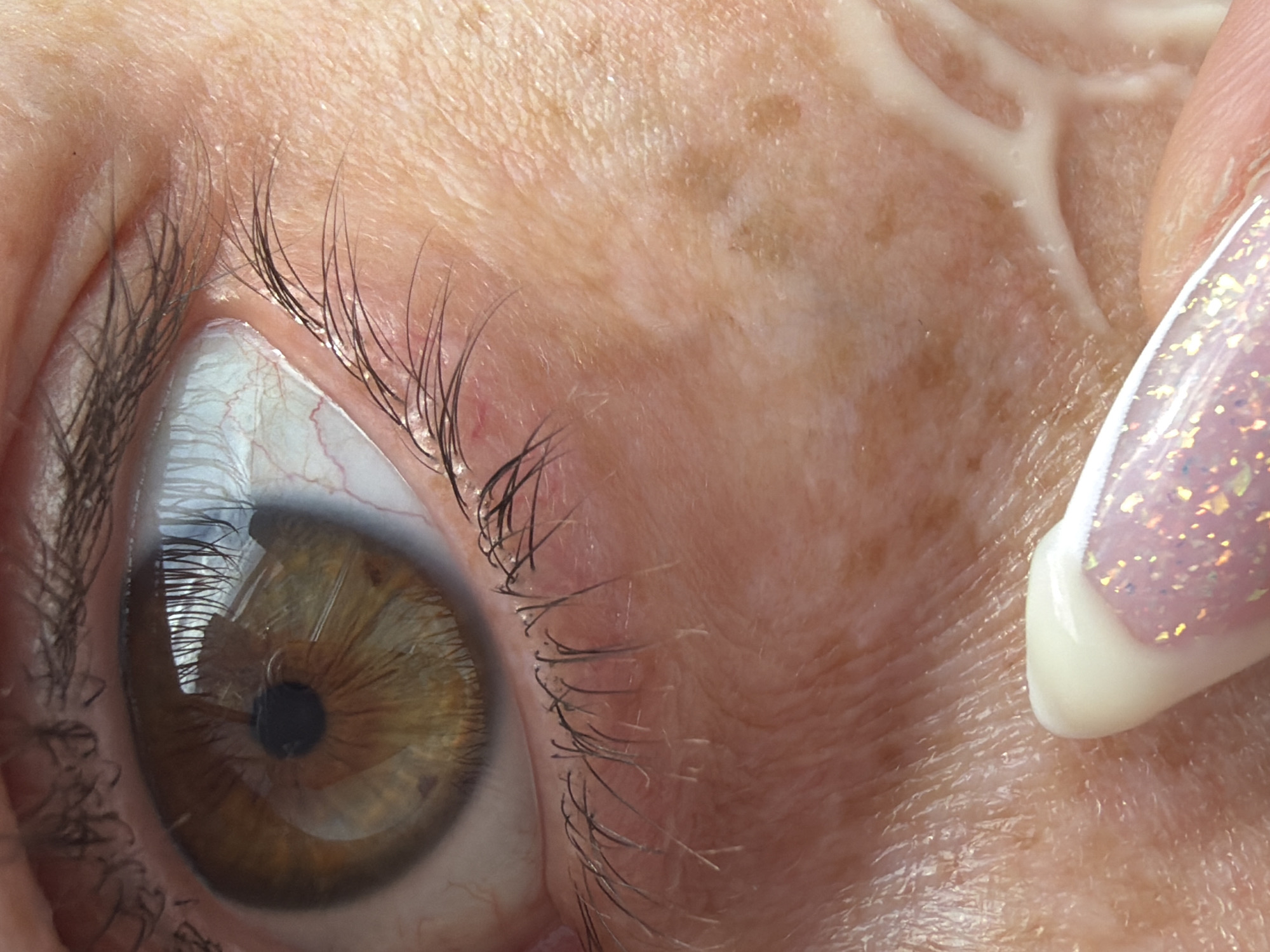 A close-up of a human eye, likely female, with hazel iris and surrounding skin showing signs of aging (wrinkles, freckles). Eyelashes are visible. A finger with a decorated nail (glitter and white tip) is positioned near the eye, appearing to apply a cream-like substance to the skin. There is no information to suggest this image was taken in Saint Petersburg, Russia.