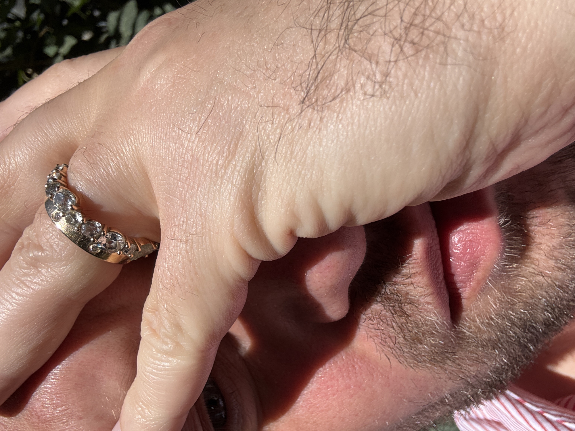 The image captures a close-up, high-angle view of a person's light-skinned, hairy hand shielding part of another person's face from direct sunlight. The hand, positioned prominently in the upper left, wears a gold-toned ring adorned with multiple clear, sparkling gemstones. The skin of the hand shows visible pores and fine hair.
Below the hand, the side of a second person's face is visible. This includes a portion of an eye looking upwards and outwards, an ear, a cheek with some redness, and a dark, short beard or stubble. Strong, direct sunlight casts deep shadows from the hand across the face, highlighting the texture of the skin and hair. In the blurred background, green foliage is discernible, suggesting an outdoor setting. The strong lighting indicates a bright, sunny day. The scene takes place in Milan, Italy. No text is visible in the image.