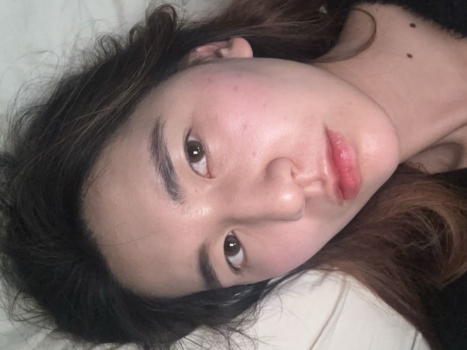 A woman with fair skin and dark brown hair poses in a close-up shot. She is lying on a white surface, presumably a bed, with her head tilted. Her dark eyebrows frame her eyes, and she has full, glossy lips. The lighting emphasizes the smoothness of her skin, which has a healthy, hydrated appearance. A few moles are visible on her neck.