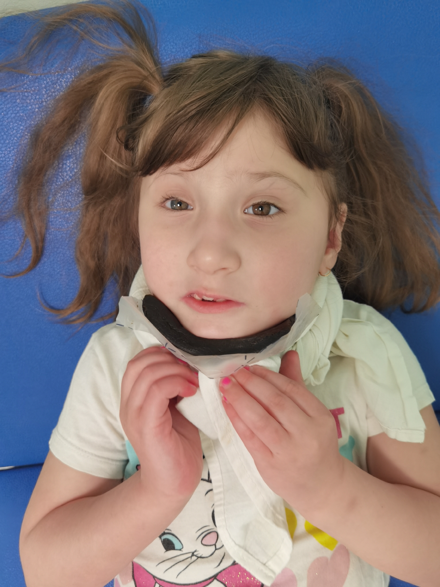 A young girl with brown hair in pigtails, wearing a white shirt with a cartoon graphic, lies on a blue surface. She has on a white neck brace with a black component visible at the front. She is holding the front of the brace with her hands. Her fingernails are painted pink. The location is Perm, Russia.