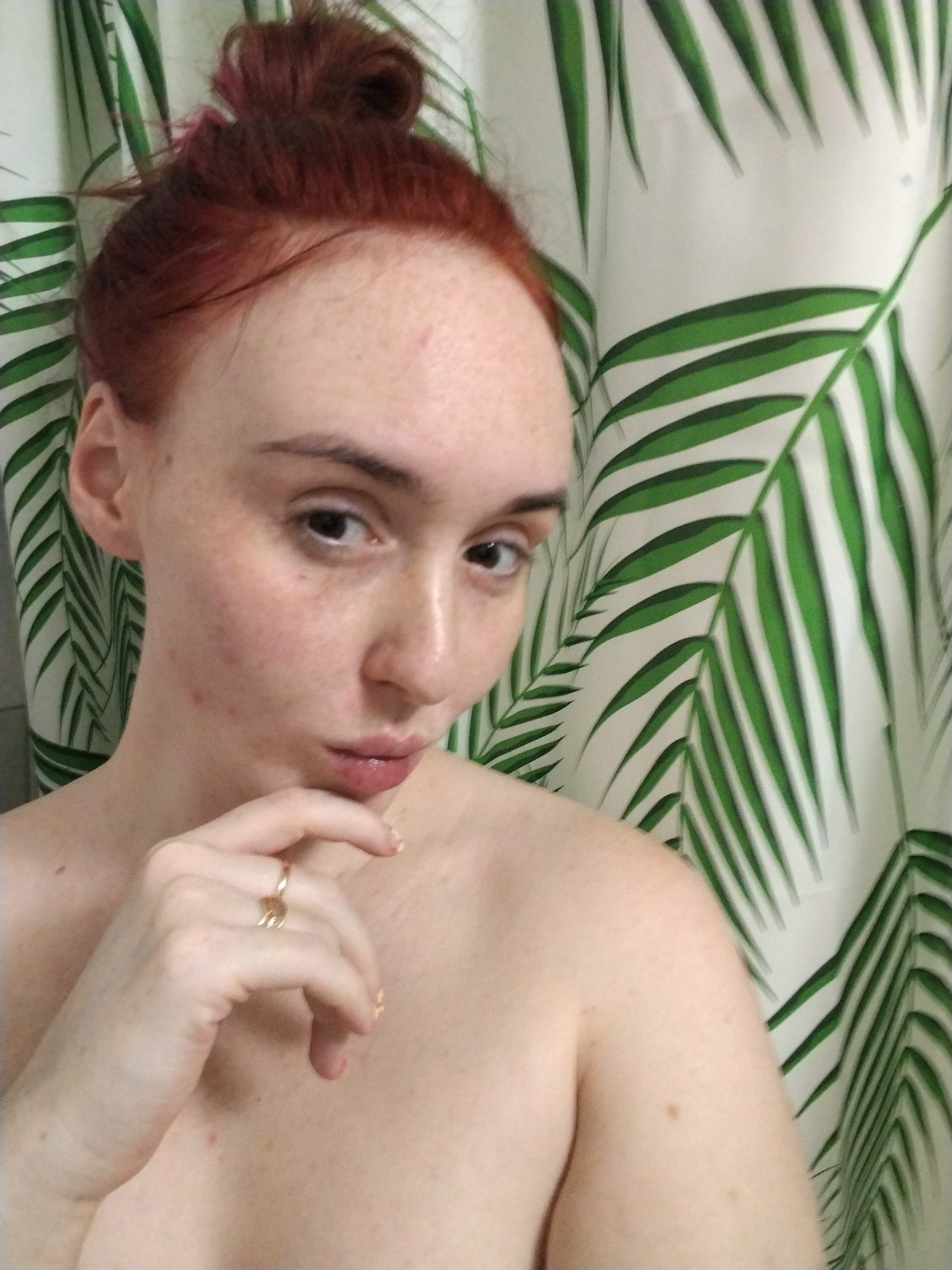 The image displays a head-and-shoulders portrait of an individual, identified as an adult female, situated indoors in front of a patterned shower curtain. The individual possesses fair skin, marked by several small reddish blemishes on the forehead and cheeks, and scattered moles across the exposed chest and shoulder area. Her hair is reddish-brown and styled into a loose bun atop her head. She has dark eyes maintaining direct eye contact with the viewer. Her lips are full, slightly parted, and exhibit a subtle pout. Her right hand is raised, with fingers curled and the thumb resting beneath her chin. A golden-colored ring with an indistinct emblem is present on the ring finger of her right hand, and her short fingernails are painted with a light-colored polish. The individual's shoulders and upper chest are bare. The background is a white fabric, consistent with a shower curtain, featuring a repeating pattern of large green palm leaves. The specific location within Izhevsk, Russia, cannot be determined from the visual evidence.