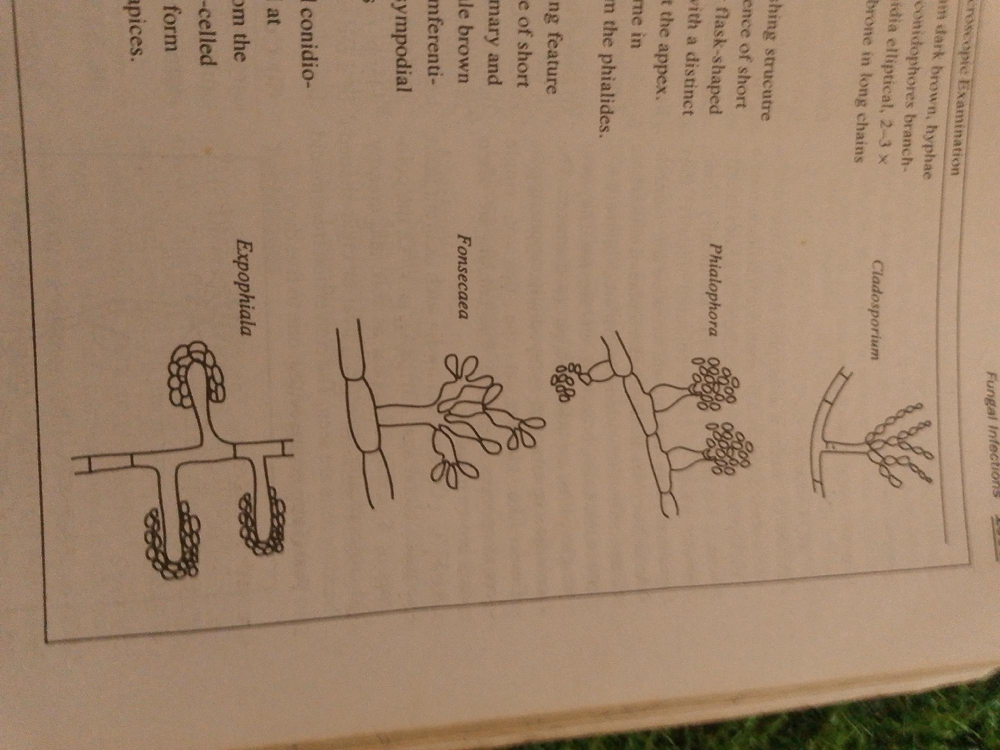 The image is a close-up, overhead shot of a book with illustrations of fungal structures and accompanying text. The subjects are the book itself and its content. The book displays line drawings of various fungal conidiophores, labeled with names like "Expophiala," "Fonsecaea," "Phialophora," and "Cladosporium." The text describes microscopic examination, hyphae, conidiophores, and characteristics of fungal reproduction. There are no people, animals, or specific environmental scenes visible. The setting is implied to be an educational or scientific context, likely a laboratory or study area where such materials would be used. No time of day, weather, or emotional cues are discernible. The text includes scientific terminology related to mycology. Some of the text also mentions "Fungal Infections."