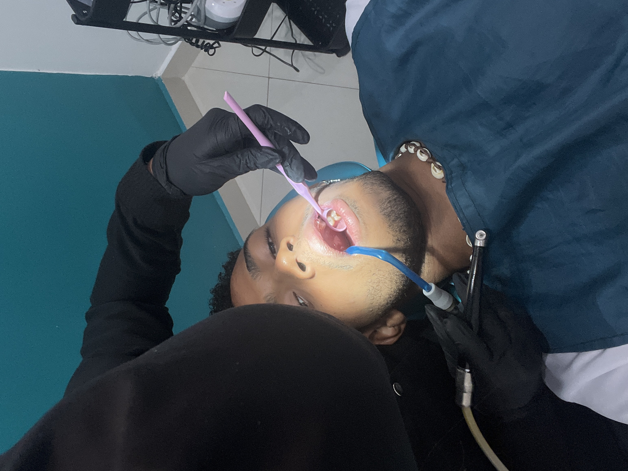 A low-angle shot depicts a dental examination in progress. A Black male patient lies supine in a dental chair, his mouth open as a dental professional wearing black gloves and a long-sleeved black garment examines his teeth using a pink dental mirror. A suction device is also present in the patient's mouth. The dentist also holds a dental tool attached to a long white hose. The patient wears a blue dental bib. The background includes a pale blue wall and a metal stand with dental equipment. The location is likely a dental office in La Asuncion, Venezuela.