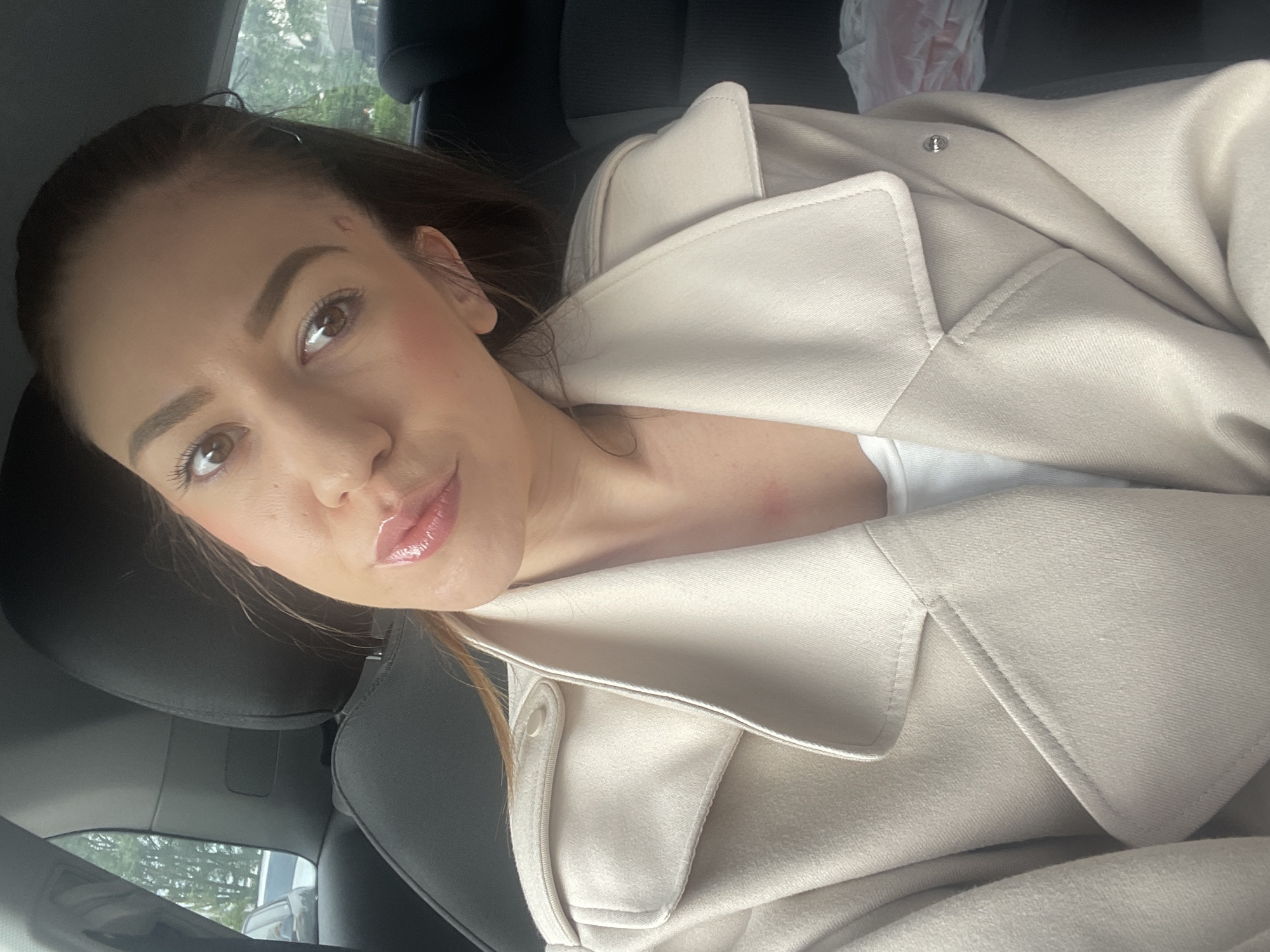 A young woman is the central subject of this close-up, diagonal portrait, appearing to take a selfie while seated in a car. She has long, dark hair, seemingly pulled back, and is looking directly at the camera with a neutral expression. Her features are accentuated with makeup, including defined eyebrows, mascara, and glossy, light pink lips.
She is wearing a light-colored, possibly beige or cream, coat or jacket with a structured collar, under which a white top or t-shirt is visible. A small silver snap button is visible on the coat. In the background, the dark interior of a car is visible, including headrests and parts of the seats. Through a car window, some soft green foliage from trees or bushes can be seen, indicating an outdoor setting during daytime with diffused or overcast light. A partially obscured white and pink plastic bag is visible in the upper right.
Notable details include a faint reddish mark or slight bump on her forehead near the hairline, and some subtle reddish marks on her neck and chest area. No visible text is present in the image. The setting is a car in Sofia, Bulgaria, based on the provided context.