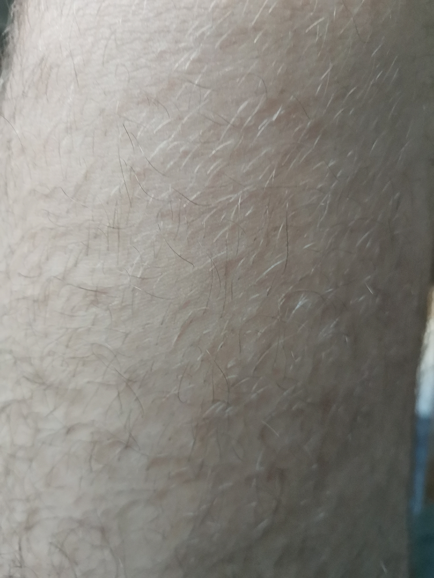 This image presents a detailed, magnified view of light-toned human skin, extensively covered with hair. The skin surface shows fine epidermal lines and texture, consistent with normal anatomical features. Predominantly, there are numerous fine, light-colored vellus hairs distributed across the surface. Interspersed among these vellus hairs are a lesser number of thicker, darker terminal hairs. The hair appears to lie relatively flat against the skin, exhibiting varied directions. No scars, tattoos, lesions, or other identifying skin marks are discernible. The background is out of focus, suggesting a shallow depth of field, and provides no additional contextual information or discernible objects. No individuals or specific actions are depicted beyond the close-up of the skin and hair. This image is associated with the city of Pokrovnik, Bulgaria.