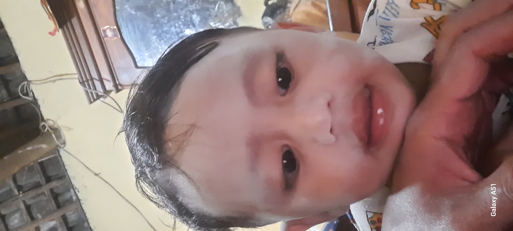 The provided image is a close-up of a young child's face. The child has dark hair and appears to be looking forward. The skin on the child's face has some light patches, particularly on the forehead and around the eyes and mouth. The child's lips are slightly parted, revealing two small teeth. A portion of an adult's hand is visible in the lower part of the frame, resting near the child's face. The background is blurry but suggests an indoor setting with some wooden furniture and possibly a ceiling structure. The text "Galaxy A51" is visible in the bottom left corner, indicating the device used to capture the photo. No specific location within Jatitengah, Indonesia, can be determined from the visual information alone.