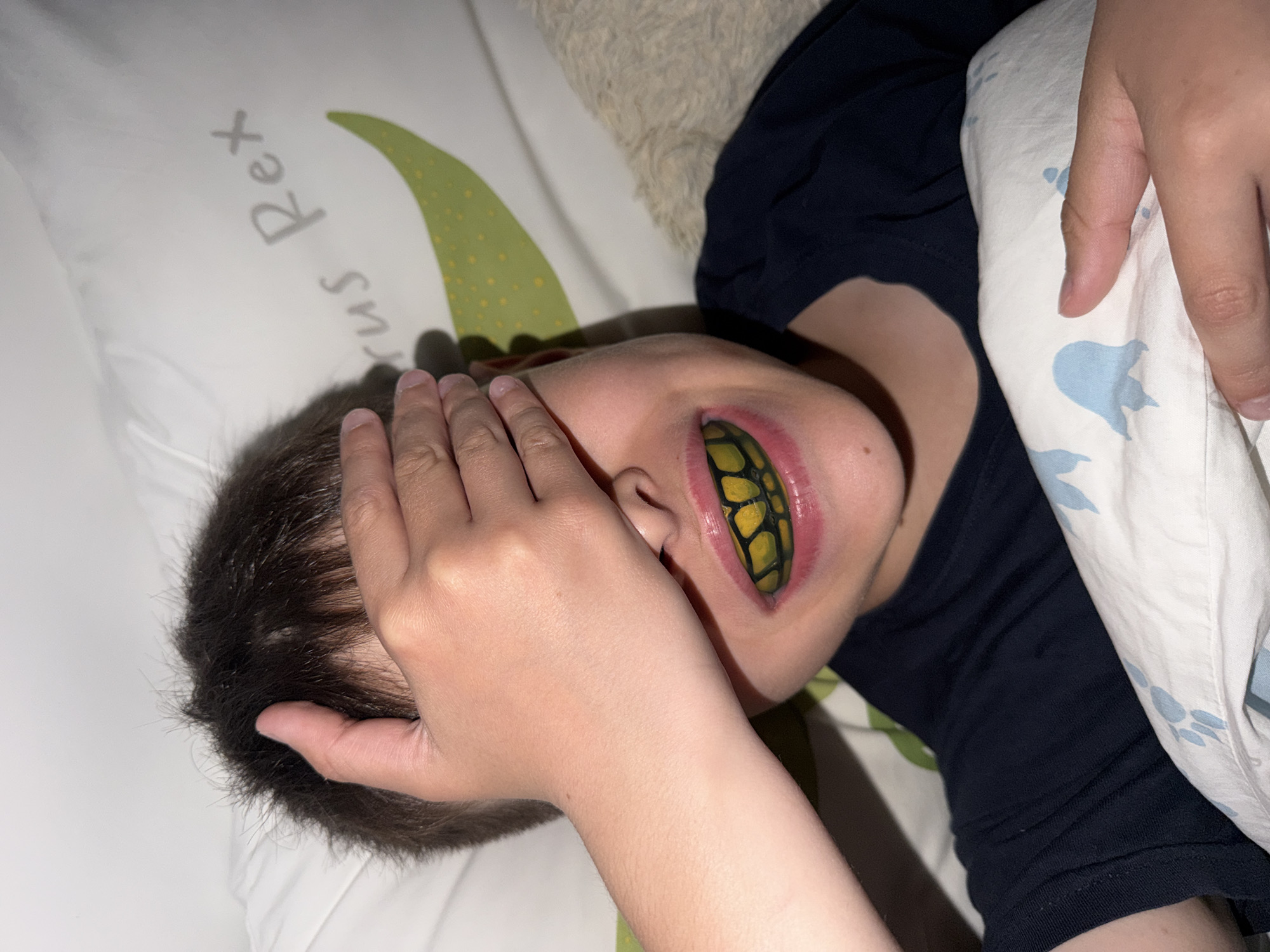 A child lies in bed, covering their face with their hand. Their mouth is open, revealing a green and yellow object. The bed is covered in patterned linens. The location is unknown and there is no indication that this is in Votkinsk, Russia.