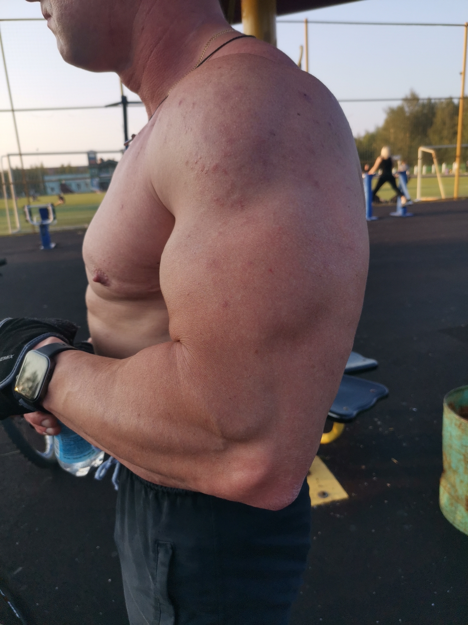 The image shows a close-up, side view of a muscular man's torso and arm. He is wearing dark athletic shorts and a black watch on his left wrist. His skin appears reddish, and there are some small blemishes visible on his shoulder and upper arm. A thin gold chain is around his neck.
In the background, an outdoor fitness area is visible. Several pieces of exercise equipment, including what appear to be parallel bars and a leg press machine, are present. Two other individuals can be seen in the distance, one using a piece of equipment. The scene suggests a park or public gym. The lighting indicates it is daytime, likely late afternoon or early evening, given the soft, warm light. The sky is a light blue, suggesting clear weather. The overall setting appears to be a recreational area in Kizel, Russia, consistent with the provided location context. No specific emotions are discernible from the man's posture or the partial view of his face. There is no visible text in the image, other than faint lettering on the man's glove which is difficult to read.