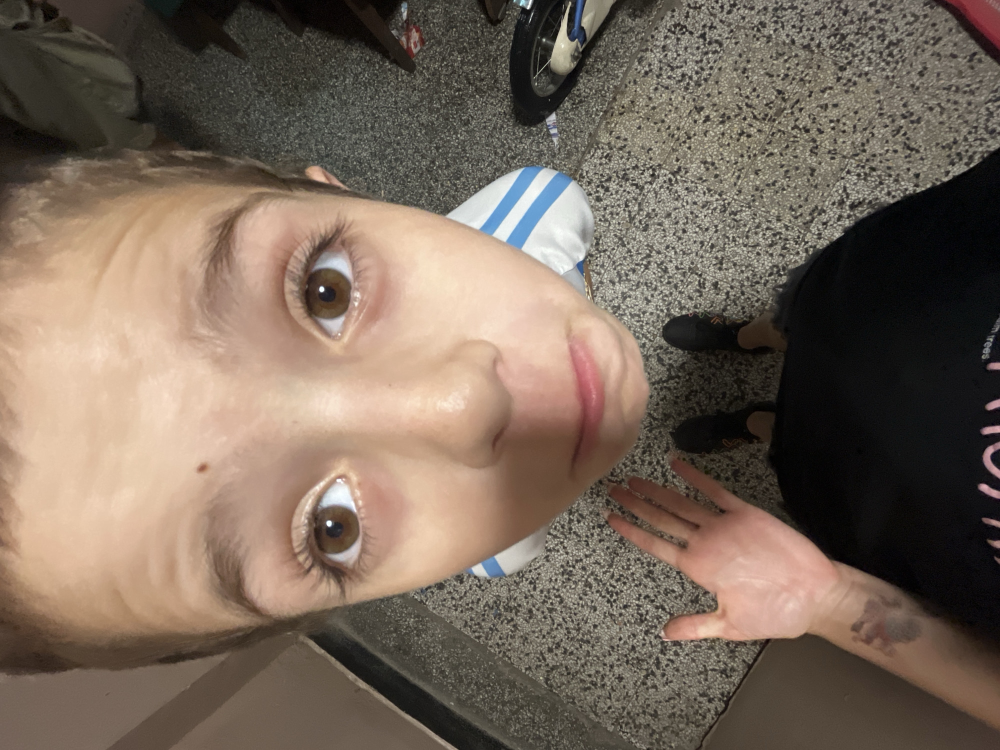 The image shows a close-up, overhead view of a person's face and arm. The person has brown eyes and light skin, with some light blush on their cheeks. They are wearing a white shirt with blue stripes. Their left hand is raised and open, with its palm facing upwards. There is a dark, bruise-like mark on their left forearm. The background appears to be a floor with a speckled pattern, and a portion of a bicycle wheel is visible in the upper right. The overall lighting suggests it is daytime, but the specific time or weather is not discernible. The scene seems to be indoors, possibly a home or public space with a durable floor. No discernible text is visible in the image.