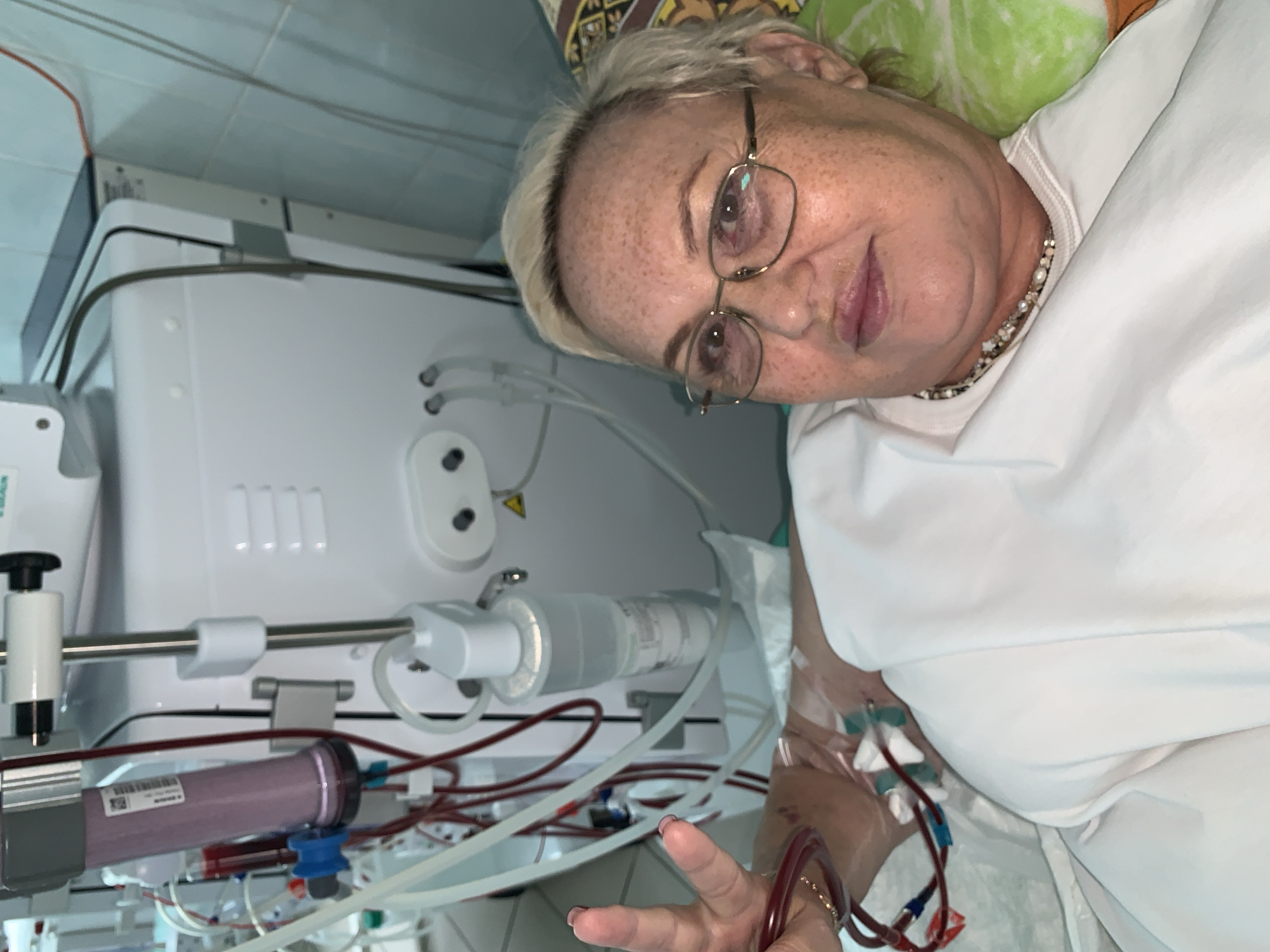 The image shows a woman lying in a hospital bed with a dialysis machine in the background. The woman is wearing glasses and a necklace. Her left arm is connected to the dialysis machine via tubes. The dialysis machine is white and has a cylindrical filter attached to it. The room appears to be a hospital room, with tiled walls and a bed. The overall impression is one of a medical procedure in progress.