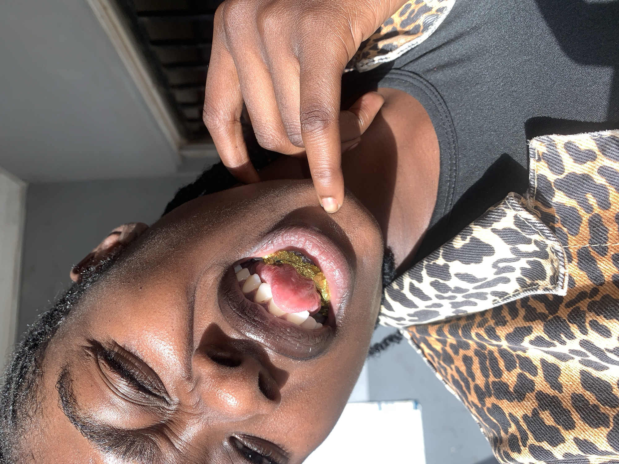 The image presents a close-up, angled portrait of a dark-skinned individual located in New Stadium, Nigeria, under harsh, direct sunlight. The person's right eye is tightly squinted, showing numerous creases, while the left eye is also partially closed, indicating intense light exposure. Their mouth is wide open, revealing white upper and lower teeth. The tongue is partially curled and extended, displaying a pinkish-red surface. Resting against the lower teeth and gums, beneath the tongue, is a crumpled, reflective object with a distinct yellow-gold color and texture resembling crinkled foil, possibly encasing a food item.
The individual's right hand is raised to their face, with fingers bent, and the index finger lightly touches their right cheek below the mouth. The fingernails on the visible fingers are short and appear unpolished. They are wearing a jacket or shirt with a prominent tan, black, and cream leopard print pattern over a plain black t-shirt with a ribbed neckline.
The strong sunlight creates stark highlights across the forehead, nose, lips, and knuckles, while casting deep shadows under the chin and within the mouth. The background on the left is a bright, indistinct white area. To the upper right, a plain grey wall is visible, with faint dark, grid-like structures (likely security bars on a window) and a lighter horizontal frame line further in the background, suggesting an indoor or semi-enclosed setting with a view towards an exterior.