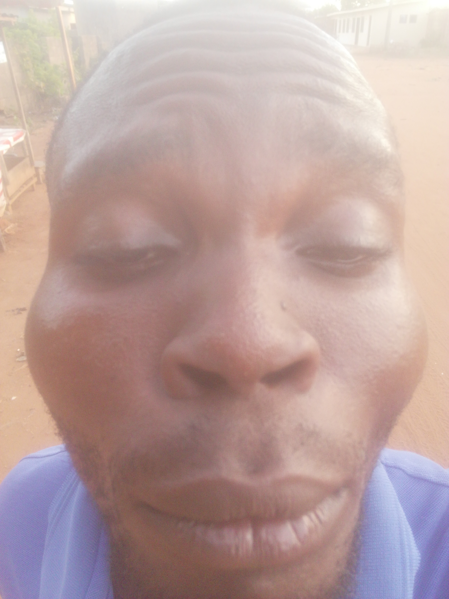 The image depicts a close-up, head-and-shoulders view of a dark-skinned individual, likely male, with eyes closed. The individual's cheeks appear swollen. The background shows an indistinct outdoor setting, possibly a street in an urban area, with buildings and other structures blurred in the distance. The location is given as Unknown, Unknown.