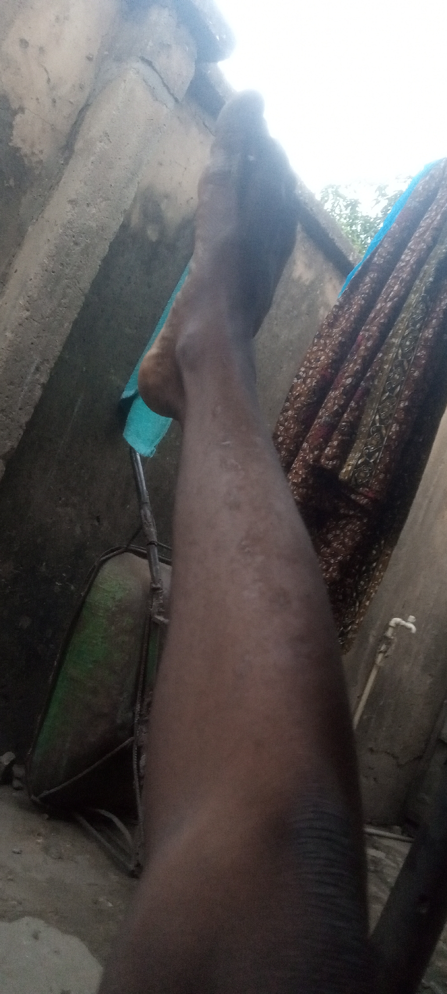 A dark-skinned human leg is prominently displayed in the foreground. The foot rests on a blue object attached to a metal frame, possibly part of a wheelbarrow. Behind the leg are rough concrete walls, with a patterned cloth hanging on one wall. A water tap is visible on the right wall. To the left of the leg, a portion of a green-painted wheelbarrow is visible. The setting appears to be an outdoor area, potentially a backyard or construction site in Sabon Tasha, Nigeria.