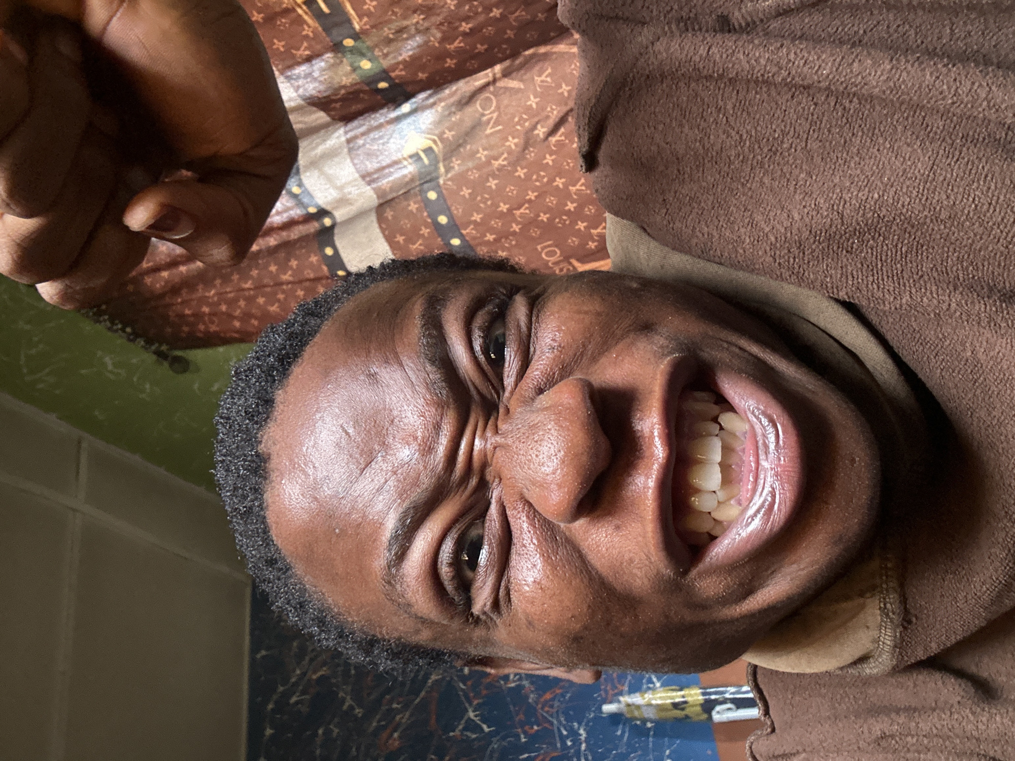 A close-up, slightly tilted portrait shows a dark-skinned person with their face contorted in a grimace or exaggerated expression. The individual has tightly furrowed eyebrows and their mouth is open, revealing teeth. They are wearing a brown hooded garment. A hand with clenched fingers is visible in the upper left corner of the image. The background includes a surface with a brown pattern reminiscent of a luxury brand and what appears to be a green wall or surface. The city and specific location are unknown.