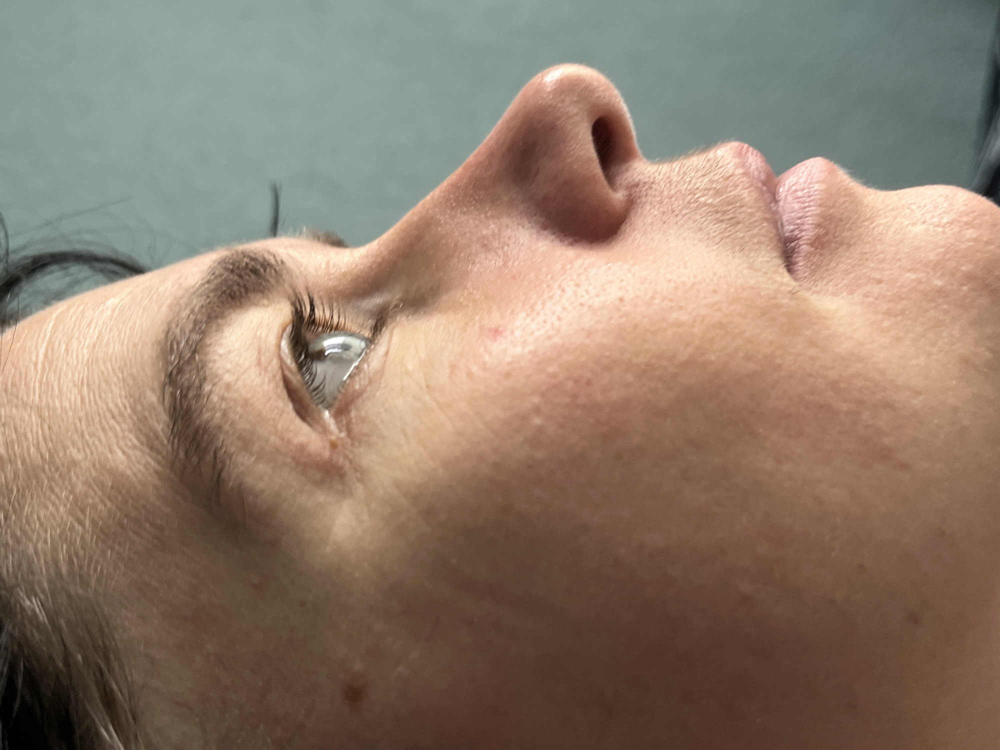 A close-up, profile view of a woman's face, angled to the right, against a muted teal background. Her skin is fair with visible pores and some fine lines on her forehead and under her eye. A small mole is present on her cheekbone. Her eyebrows are dark and well-defined. Her eye, with a grey iris and dark lashes, is partially visible, reflecting light. The bridge of her nose is prominent, with a slightly bulbous tip. Her lips are full and slightly parted. The image is well-lit, highlighting the texture of her skin and facial features. No specific location within ღრმაღელის თემი, Georgia, can be determined from the image.