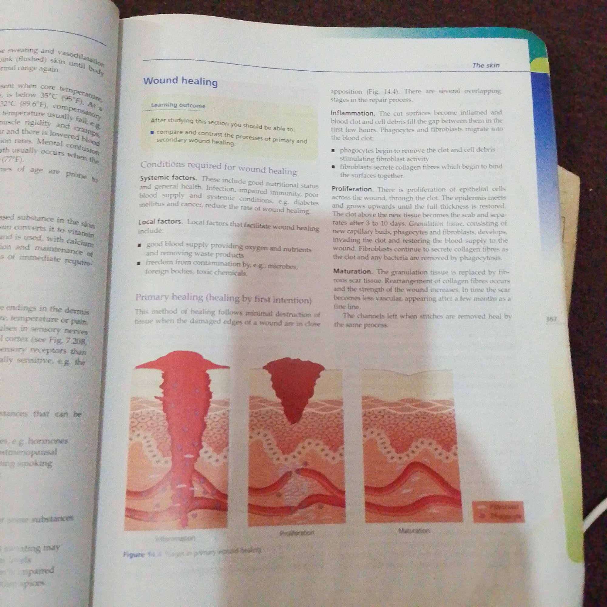 The image displays a page from a textbook discussing wound healing. The text is accompanied by illustrations showing the process of wound repair in the skin. The page is divided into sections such as "Wound healing," "Learning outcome," "Conditions required for wound healing," "Primary healing (healing by first intention)," "Inflammation," "Proliferation," and "Maturation." There is also a figure labeled "Figure 14.4 Stages in primary wound healing" which depicts three stages of wound healing. The location in Jalingo, Nigeria is not mentioned in the image.