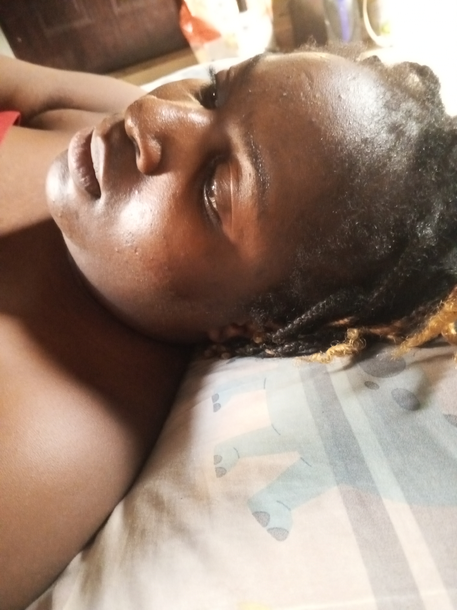 A close-up, side profile shot shows a person lying down, possibly on a bed. The person's face is turned to the right, with their eyes closed, suggesting they are asleep or resting. Their dark skin is visible, with some shine on the forehead and nose, indicating light or perspiration. The hair appears dark and styled in braids, with some lighter-colored strands visible towards the back. The person is wearing a red garment on their left shoulder. The background consists of a patterned fabric, possibly a pillowcase or blanket, with a light blue and white striped design featuring faint grey shapes. The overall lighting is dim. The image does not provide any information about the location within a city.