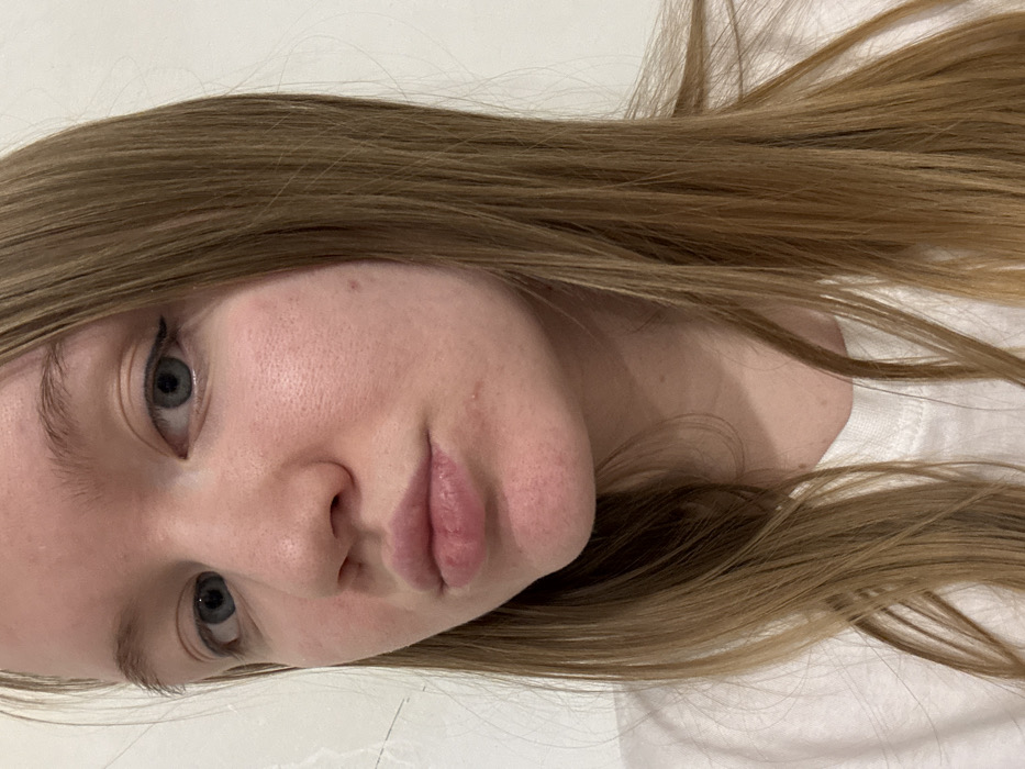 The image features a close-up portrait of a young person, likely a female, viewed from a slightly rotated perspective, as if lying down or with the camera tilted. The person's face occupies the central and left portion of the frame, with long, straight, light brown or dark blonde hair fanned out around their head and shoulders, extending towards the right side of the image.
The subject has fair skin with visible pores, particularly on the cheeks and forehead, and a few small, faint blemishes are noticeable, such as a tiny red mark on the right cheek (viewer's left) and another near the left corner of the mouth (viewer's right). Their eyes are open and looking slightly upwards and towards the viewer. The eyes are a light blue-grey color, with visible black eyeliner applied to the upper lash line, creating a subtle winged effect. The eyebrows are light brown and appear natural, without heavy grooming.
The lips are full, slightly parted, and have a natural, soft pinkish hue, appearing plump. The nose is small and appears slightly upturned. The face is generally oval-shaped. The lighting is soft and even, highlighting the features without harsh shadows.
Only a small portion of clothing is visible, which appears to be a white t-shirt or garment around the neck and shoulder area on the right side of the image. The background is a plain, light-colored surface, possibly a wall or bedsheet, providing a simple and uncluttered setting that keeps the focus entirely on the person. The overall impression is a natural, unposed, and intimate shot.