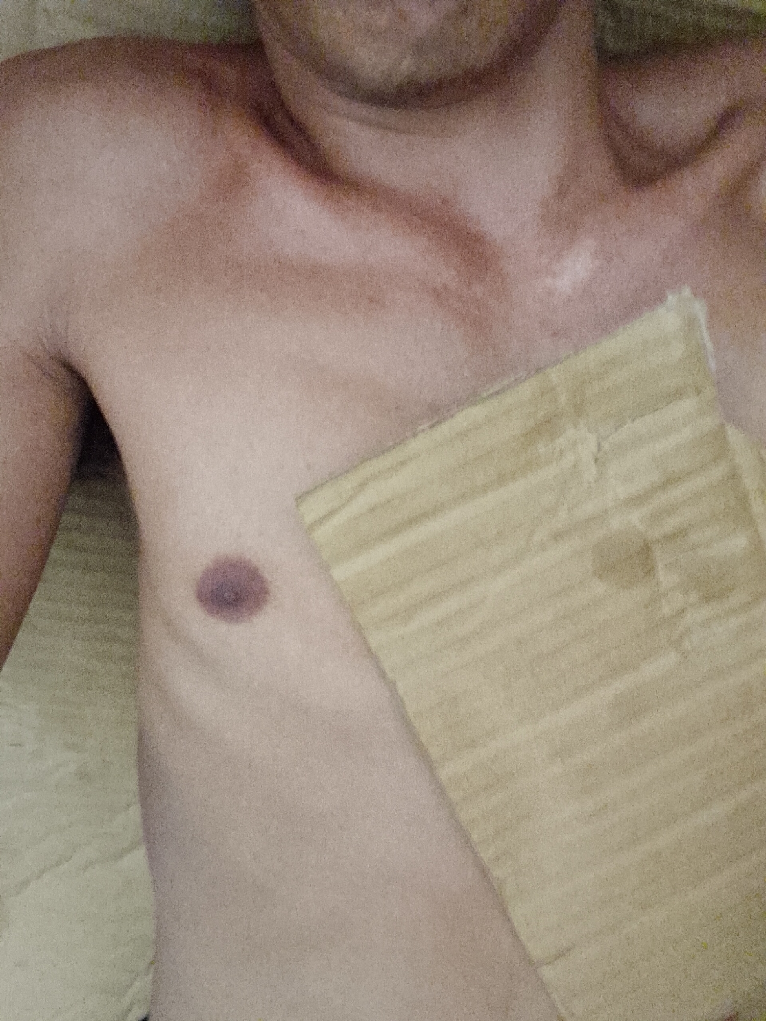 The image shows a person's torso lying on a textured, light-colored surface. The person's skin tone appears fair with some tan lines. The left nipple is visible, while a rectangular piece of cardboard is positioned over the right pectoral area, obscuring it. There are no visible indicators to place the image in Bukit Ketok, Indonesia.