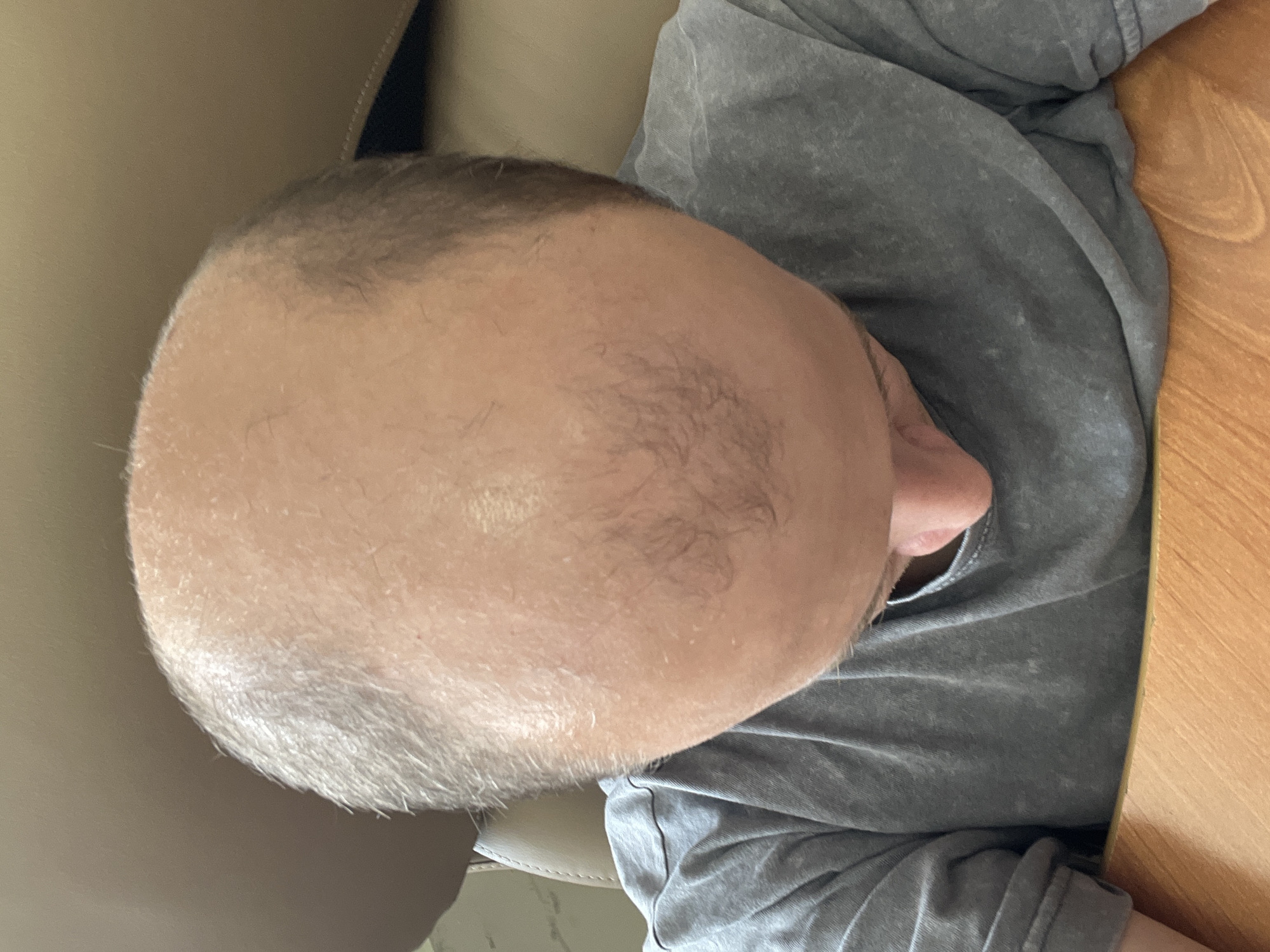 The image shows a close-up, overhead view of a man's head and shoulders. He is wearing a grey t-shirt. The man has thinning hair and is balding on the top of his head. He is looking downwards, and his face is partially obscured. He appears to be sitting at a wooden table. The background consists of a blurred beige surface, possibly upholstery. There is no indication of the location being in Omsk, Russia.