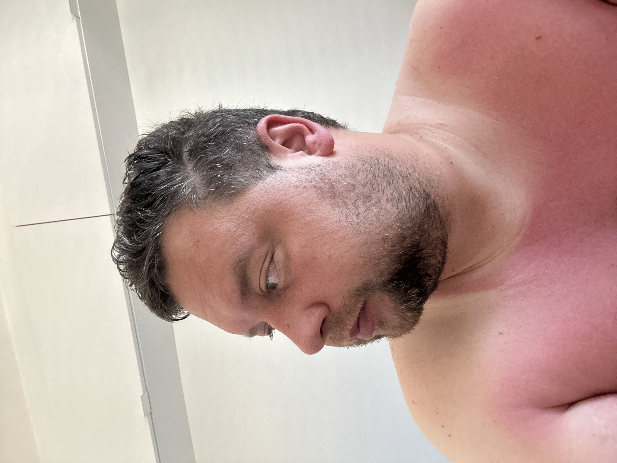 The image shows a shirtless man with sunburned skin on his upper chest and shoulder. He has short, dark hair with graying strands, a beard, and is looking down. The background is a plain white wall with a white door frame or trim visible on the left side. There is no indication in the image that the scene is located in Sant Feliu de Guíxols, Spain.