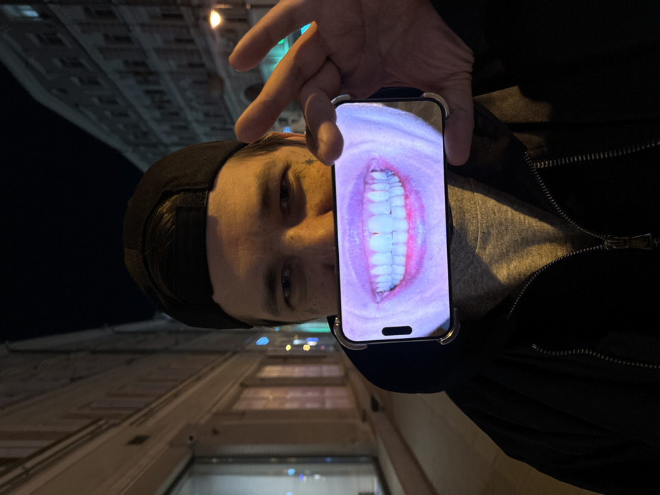 A male individual is depicted at night on an urban street in Moscow, Russia. He wears a black baseball cap reversed, a dark zippered jacket, and a grey t-shirt. His face shows visible freckles and a small dark tattoo near his right eye. He holds a silver-cased smartphone horizontally in front of his lower face, obscuring his mouth and chin. The phone, which features a "Dynamic Island" cutout on its screen, displays a brightly illuminated image of a human mouth with white teeth and pink gums in a wide smile. The individual's eyes are visible above the phone, and he is looking directly at the viewer. The background features multi-story buildings with classic architectural facades, consistent with central Moscow, illuminated by streetlights and interior lights from storefronts.