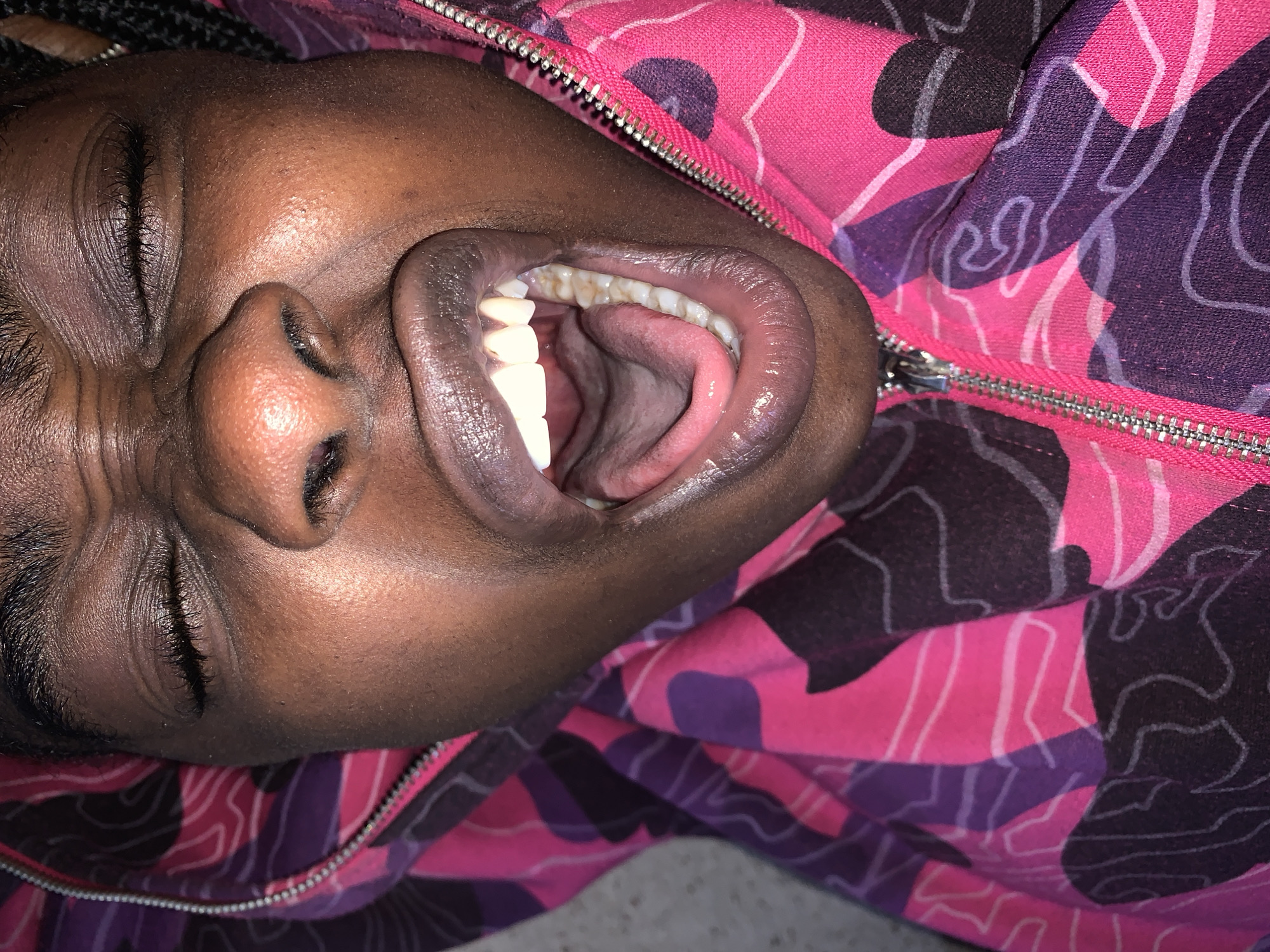 The image shows a close-up of a person's mouth and face, oriented sideways. The person is wearing a pink and purple camouflage-patterned jacket with a visible zipper. Their mouth is open, revealing teeth and tongue. The scene appears to be indoors, given the lighting and close proximity of the subjects. The image is a still photograph and does not depict any specific event or action occurring in Rafin Par, Nigeria, or any other location.