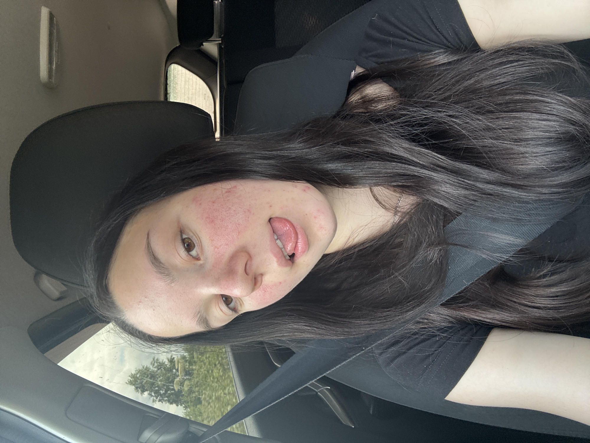 This is a vertically oriented, medium shot photograph of a young person with long, dark hair sitting in the driver's seat of a car. The person is looking towards the camera with their tongue sticking out playfully. Their face is somewhat obscured by their hair, but their eyes, nose, and mouth are visible. There are red blemishes on their cheeks.
The subject is wearing a black t-shirt, and a black seatbelt is visible across their chest. The background of the image shows the interior of a car, including the headrest of the passenger seat and a portion of the car's ceiling and window. Through the window, greenery and trees are visible, suggesting an outdoor setting. The lighting appears to be natural daylight, and the sky visible through the window seems overcast.
The image appears to be a selfie, taken by the subject themselves. The overall mood is casual and lighthearted, conveyed by the playful expression. The location context is identified as Nozhovka, Russia, though there are no specific visual cues in the image to confirm this. There is no visible text in the image.
