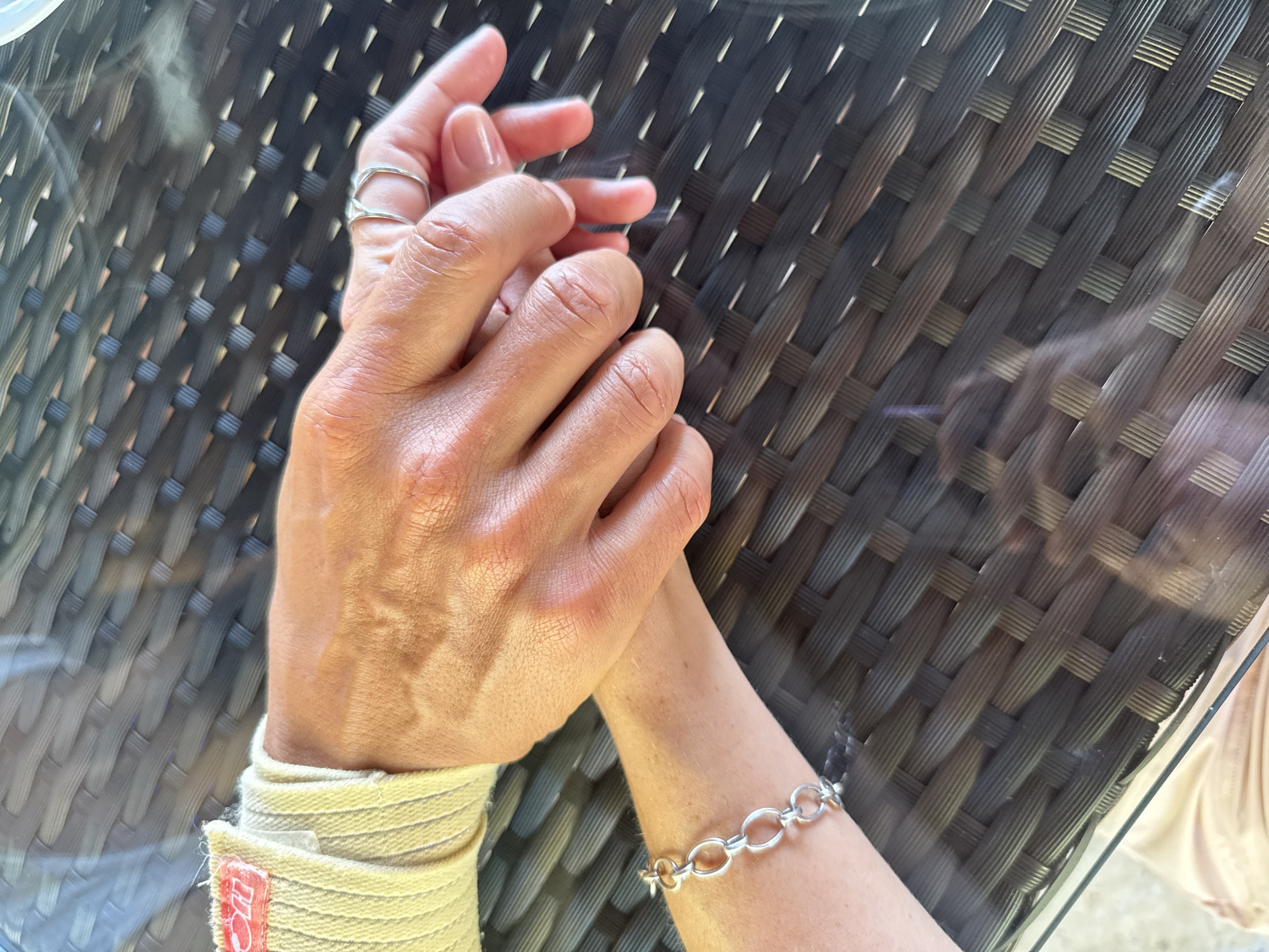 The image shows a close-up of two people's hands resting on a woven table. One person's wrist is wrapped in a light-colored bandage with a red tag. They are wearing a silver bracelet. The other person is wearing two thin silver rings on their finger. The scene is likely outdoors, as indicated by the textured table surface, which appears to be made of wicker or a similar material, and the lighting conditions. The location is not specified as Kuta Selatan, Indonesia, or any other specific city or region.