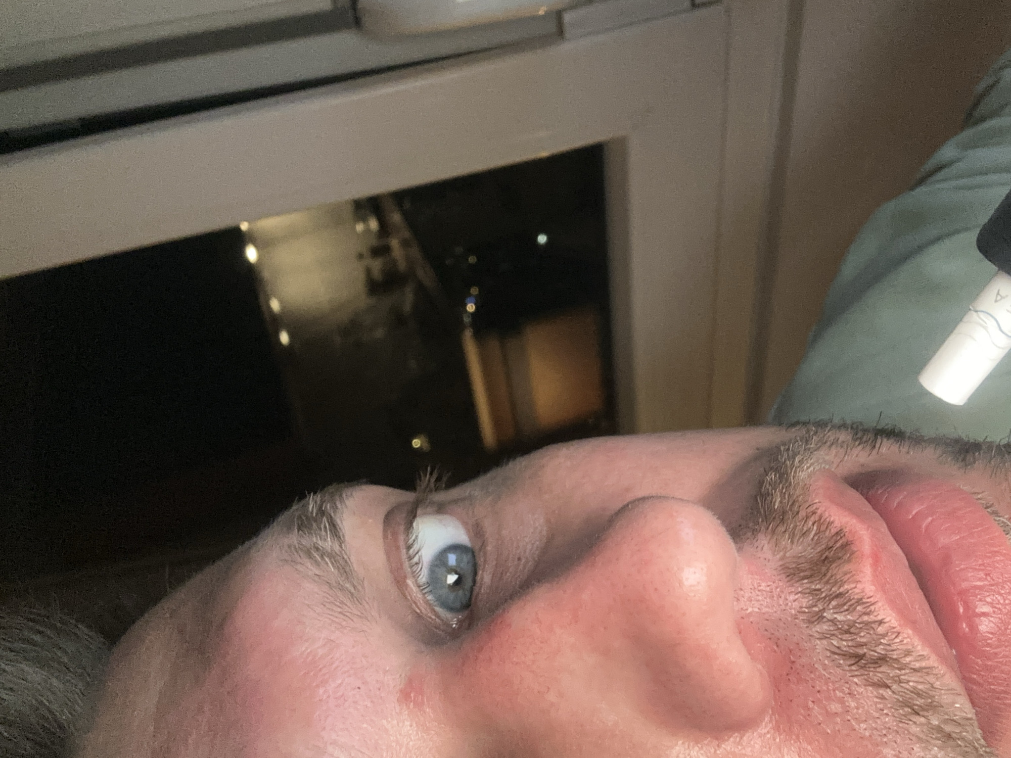 The image shows a close-up, low-angle view of a person's eye, nose, and mouth. The person appears to be looking upwards. The eye is blue with visible eyelashes and eyebrows. The skin on the face is fair and slightly flushed. The person has stubble on their upper lip and chin. A white tube with some writing on it is visible in the upper right corner of the image, partially obscuring a green fabric. The background shows a window with a dark view outside, possibly at night, with reflections of lights. The setting appears to be indoors, near a window. No specific activity or event is clearly depicted, other than the person's gaze. The provided location context of Zvezdara Urban Municipality, Serbia, does not offer specific visual cues within the image itself.