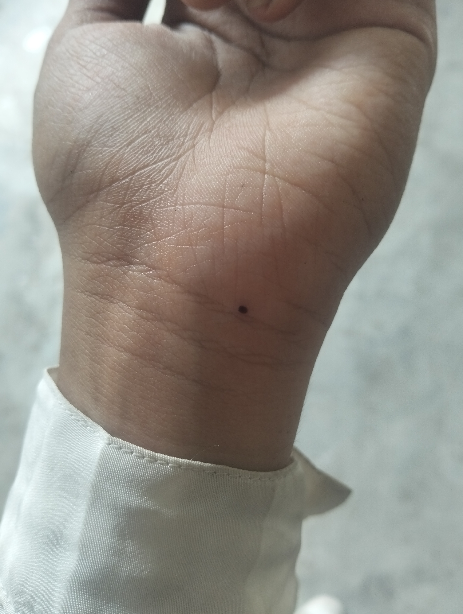 A close-up shot shows the wrist of a person with a single, small mole visible on the wrist. The person is wearing a white collared shirt. The skin tone appears to be brown. The background is out of focus and appears to be a light color. No other information is available about the location or the subject.